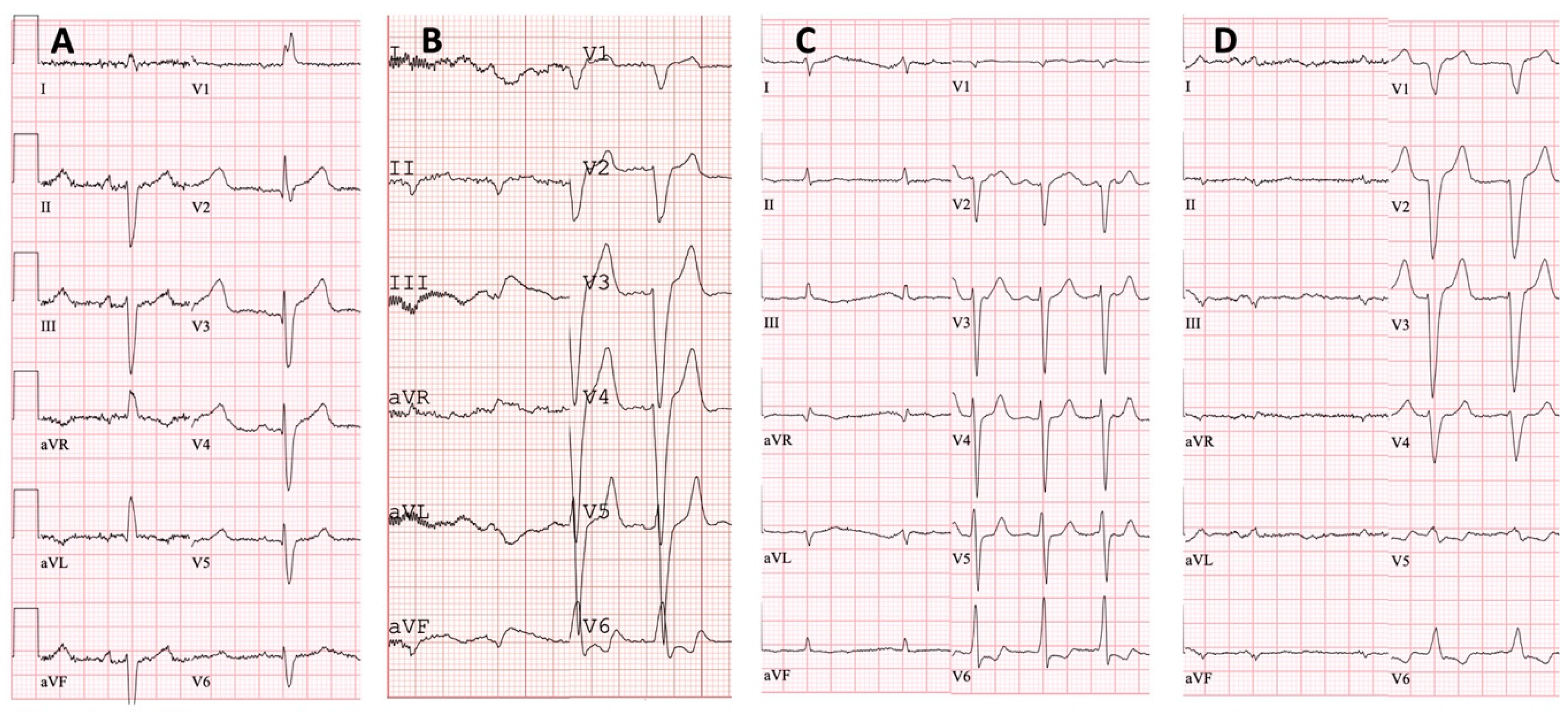 Medicina 60 00237 g004