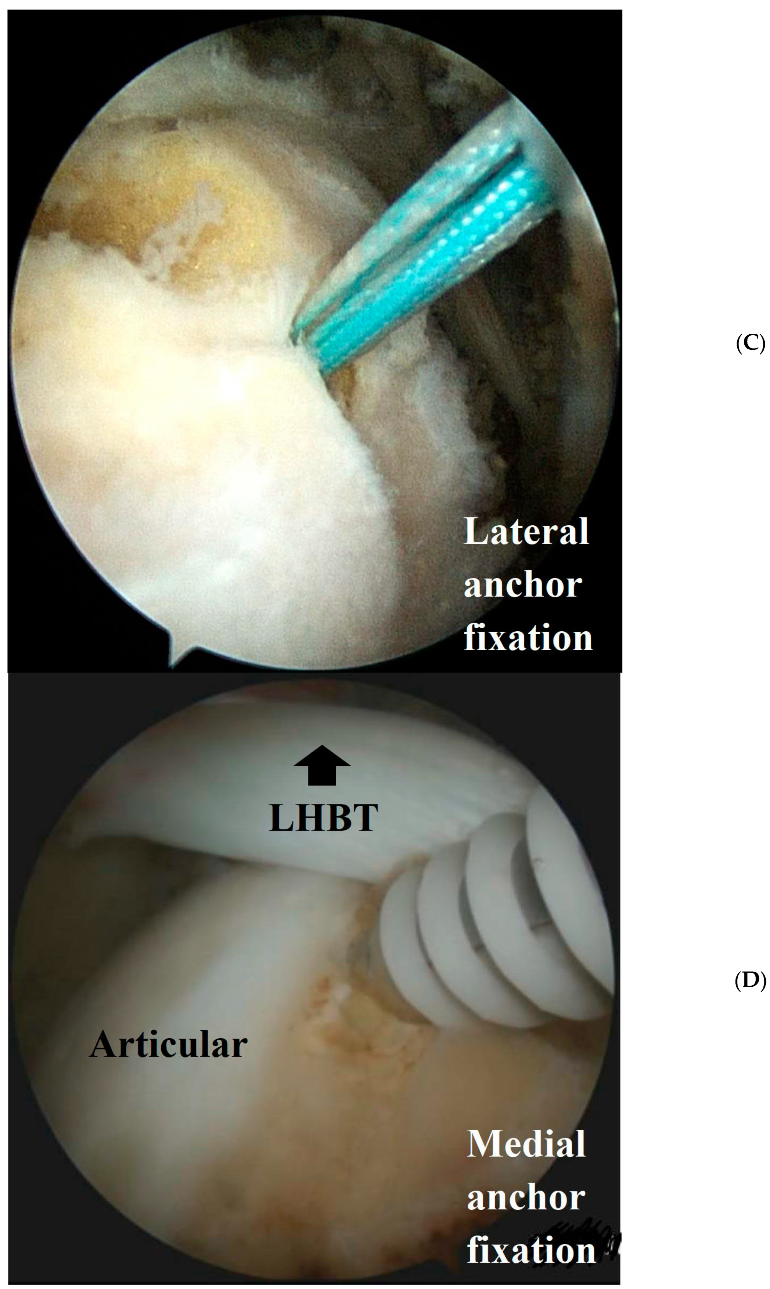 Medicina 60 00240 g001c