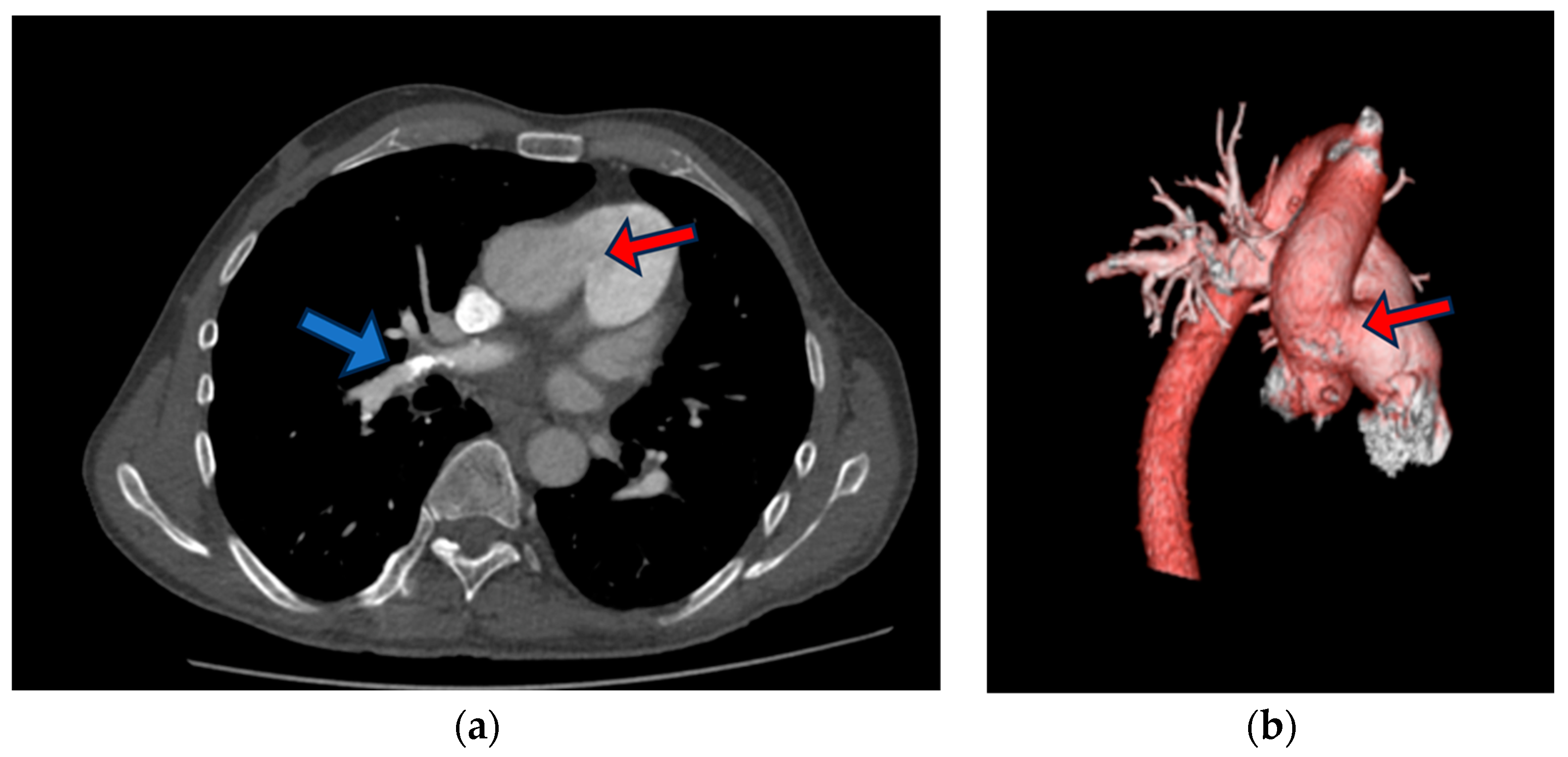 Medicina 60 00266 g003