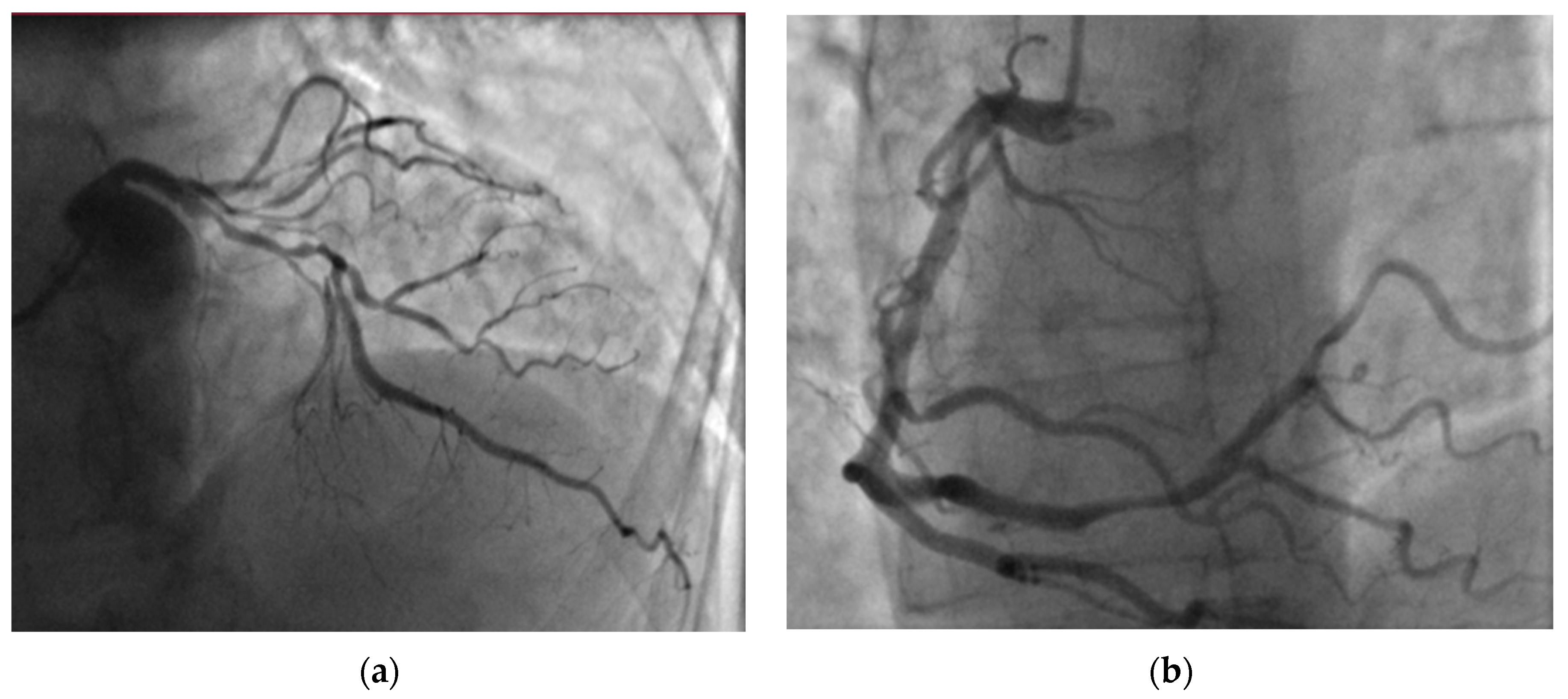 Medicina 60 00266 g004