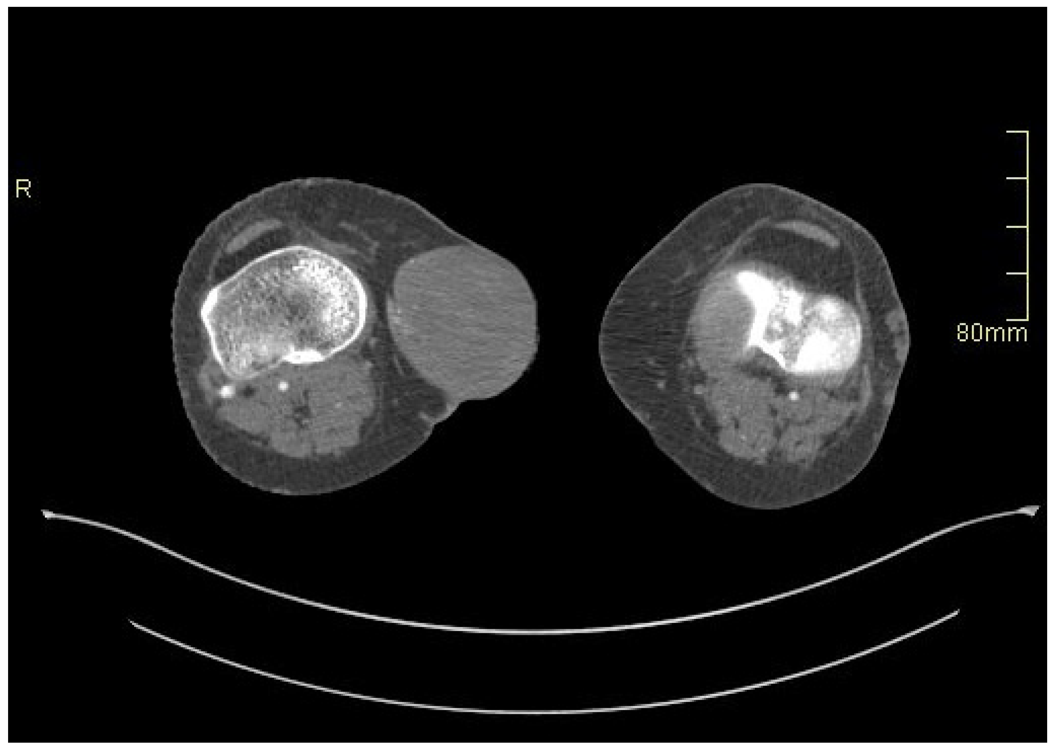 Medicina 60 00290 g002