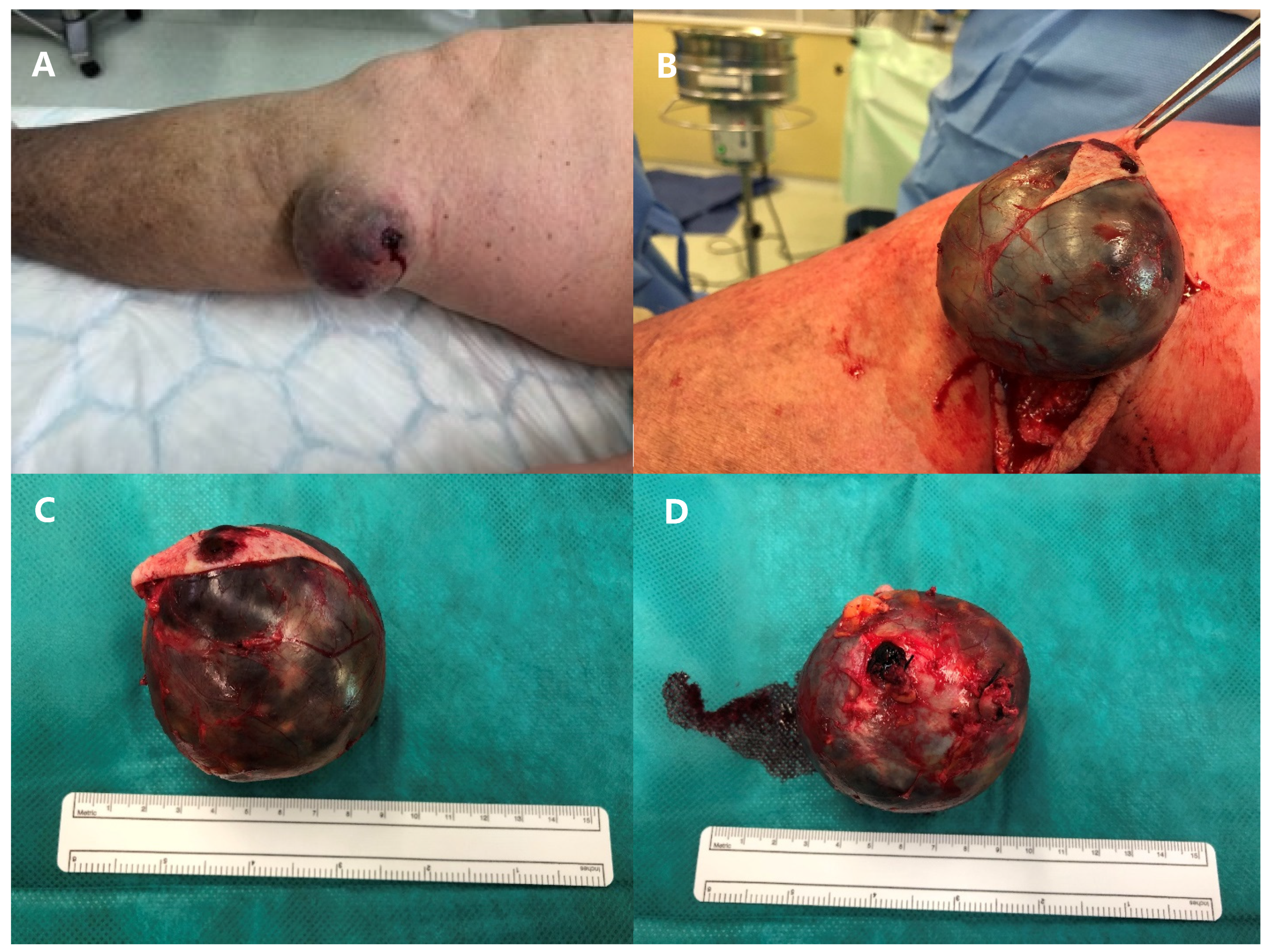 Medicina 60 00290 g003