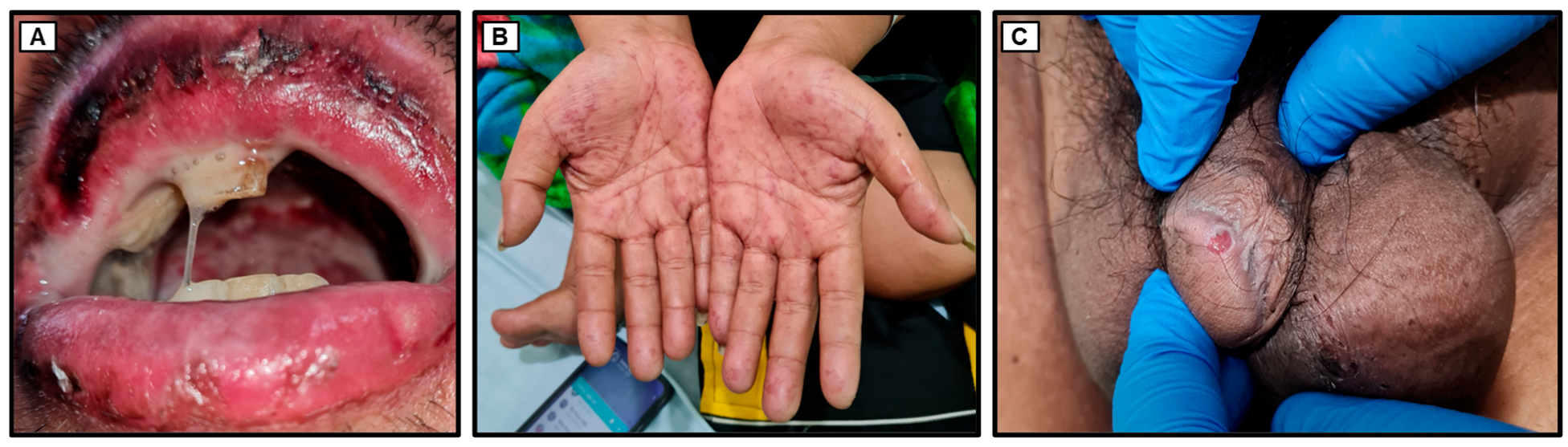 Medicina 60 00298 g001