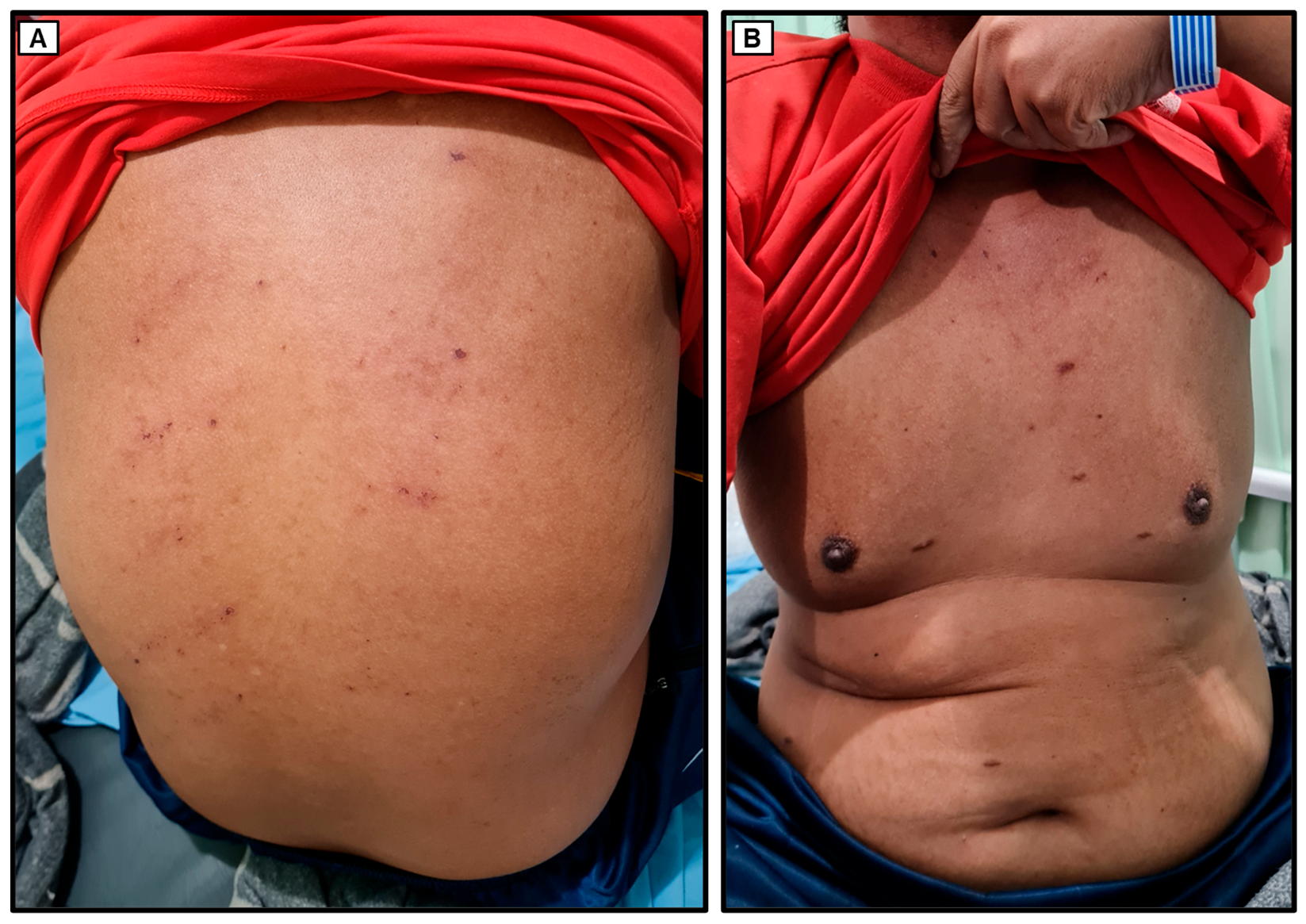 Medicina 60 00298 g002