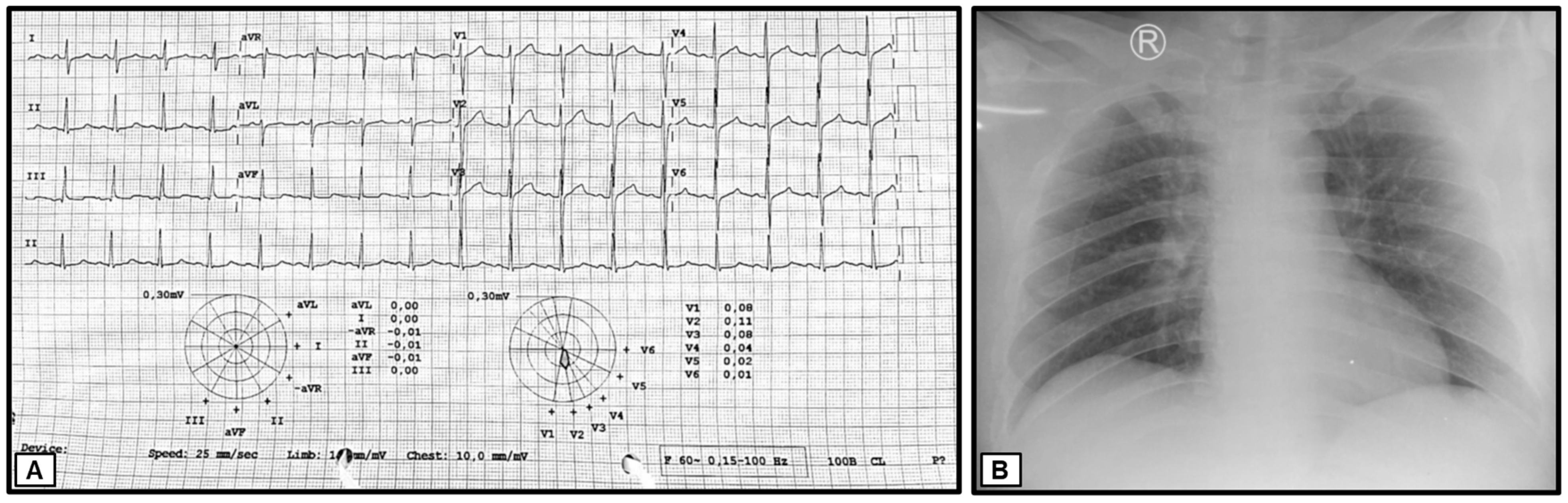 Medicina 60 00298 g003