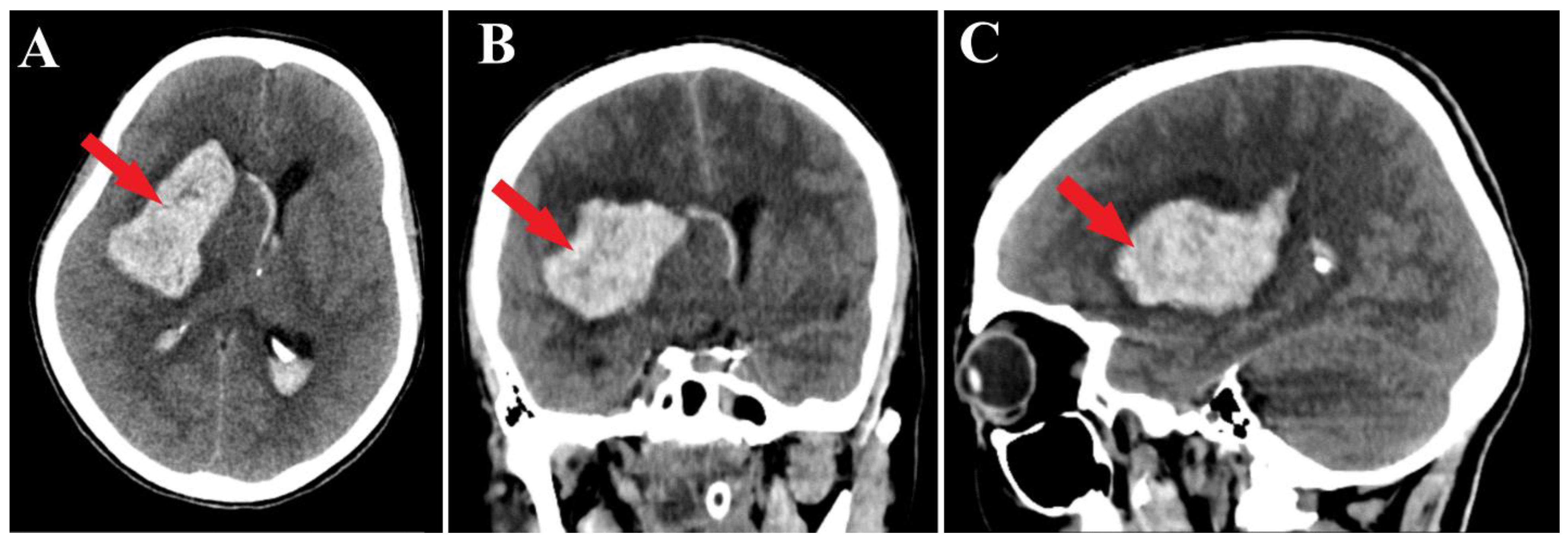 Medicina 60 00302 g001