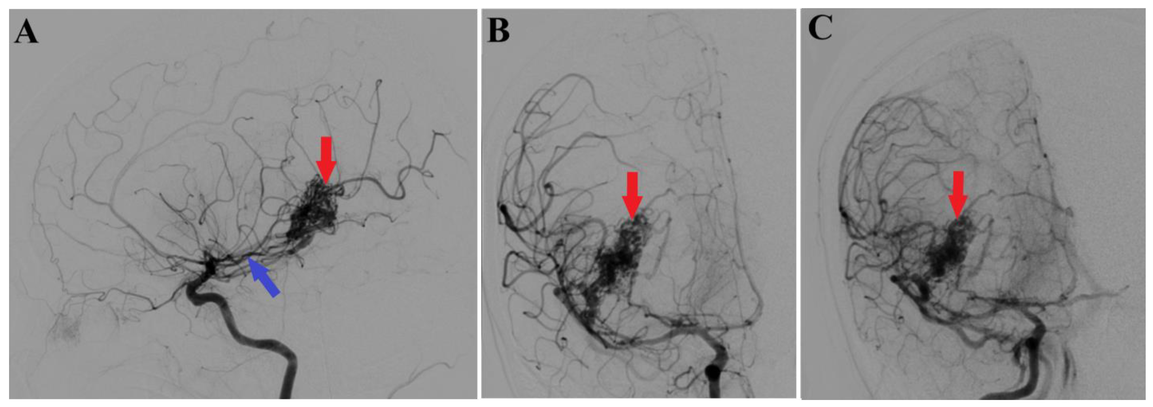 Medicina 60 00302 g002