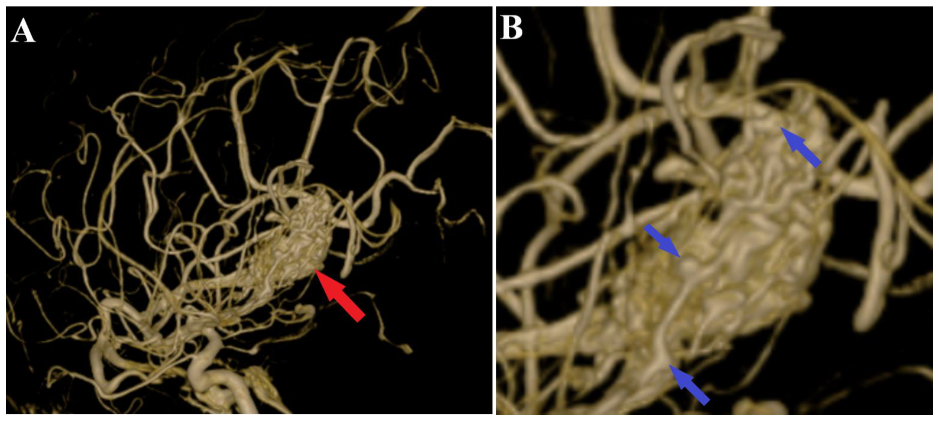 Medicina 60 00302 g003
