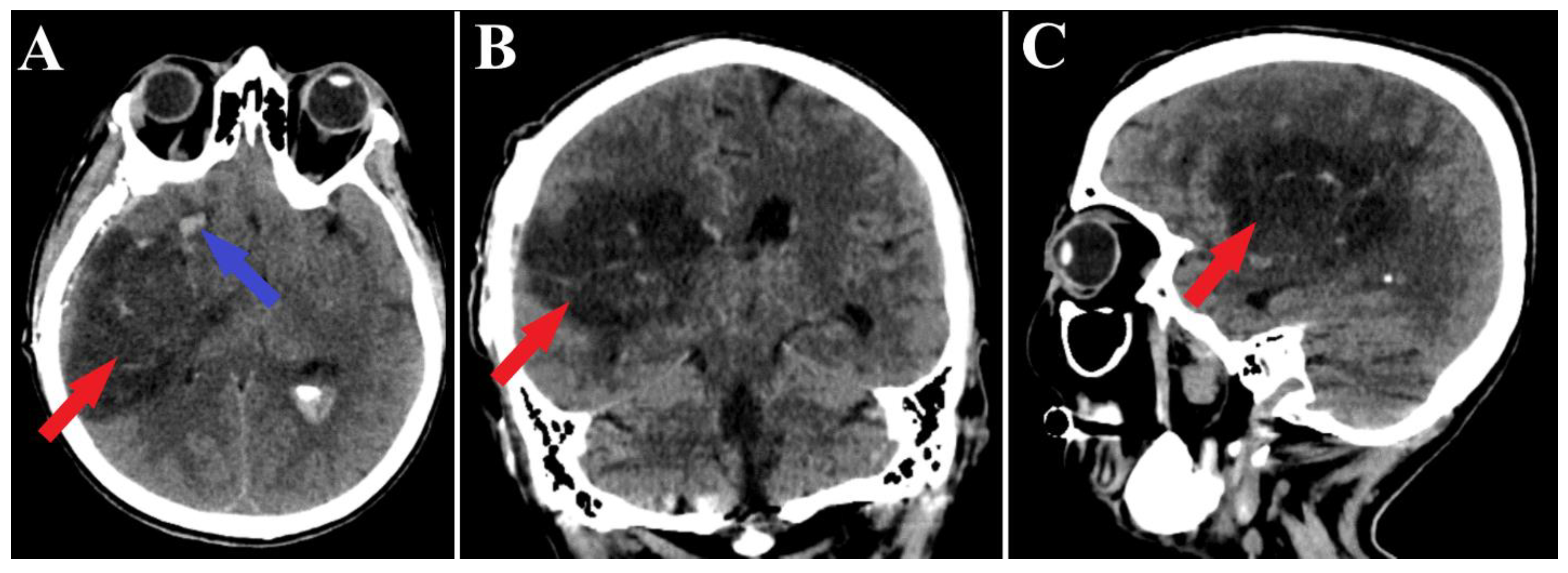 Medicina 60 00302 g004