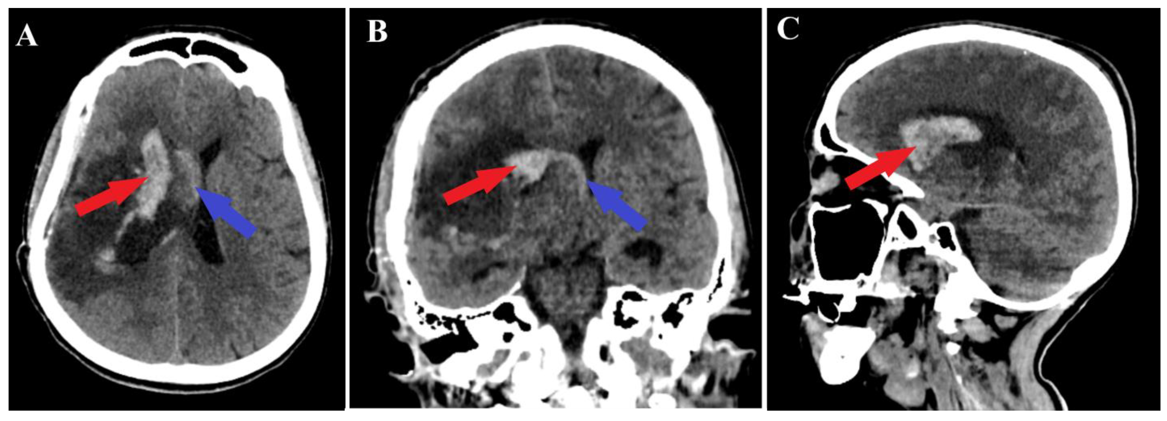 Medicina 60 00302 g005