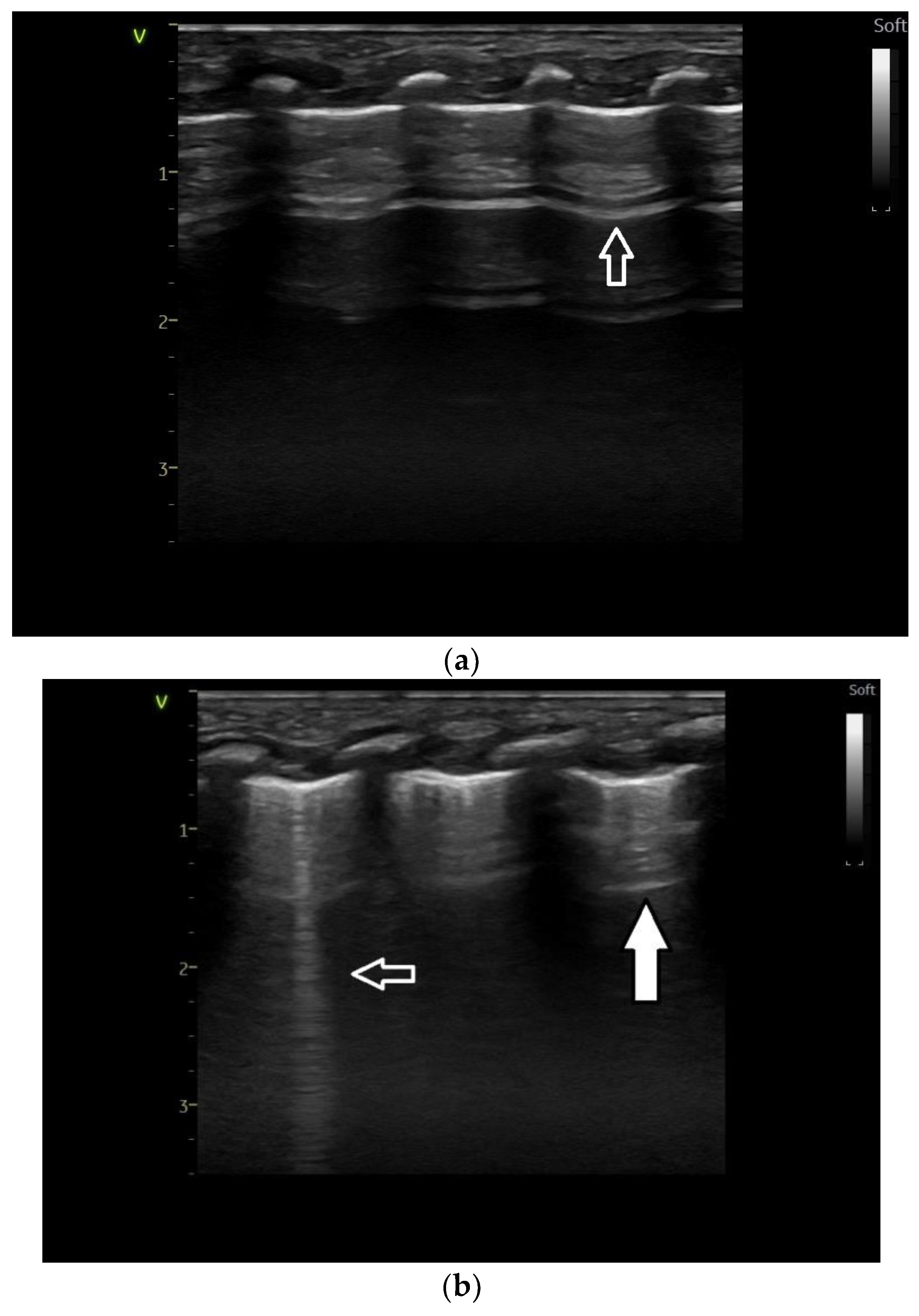 Medicina 60 00308 g001