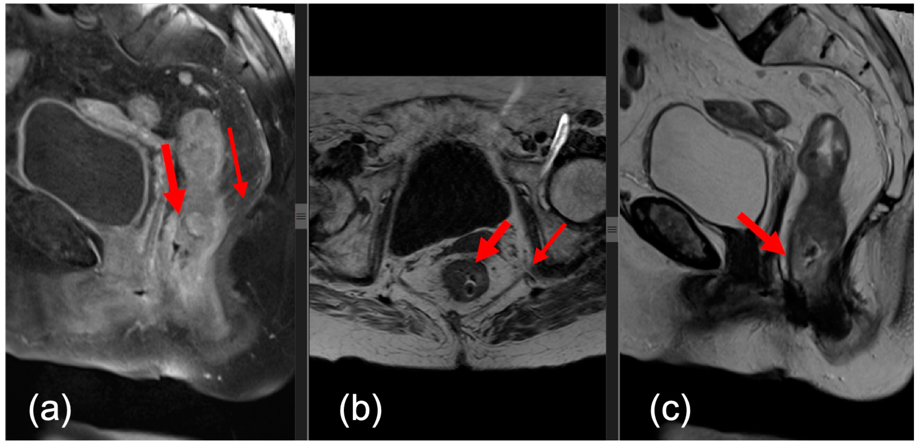 Medicina 60 00330 g002