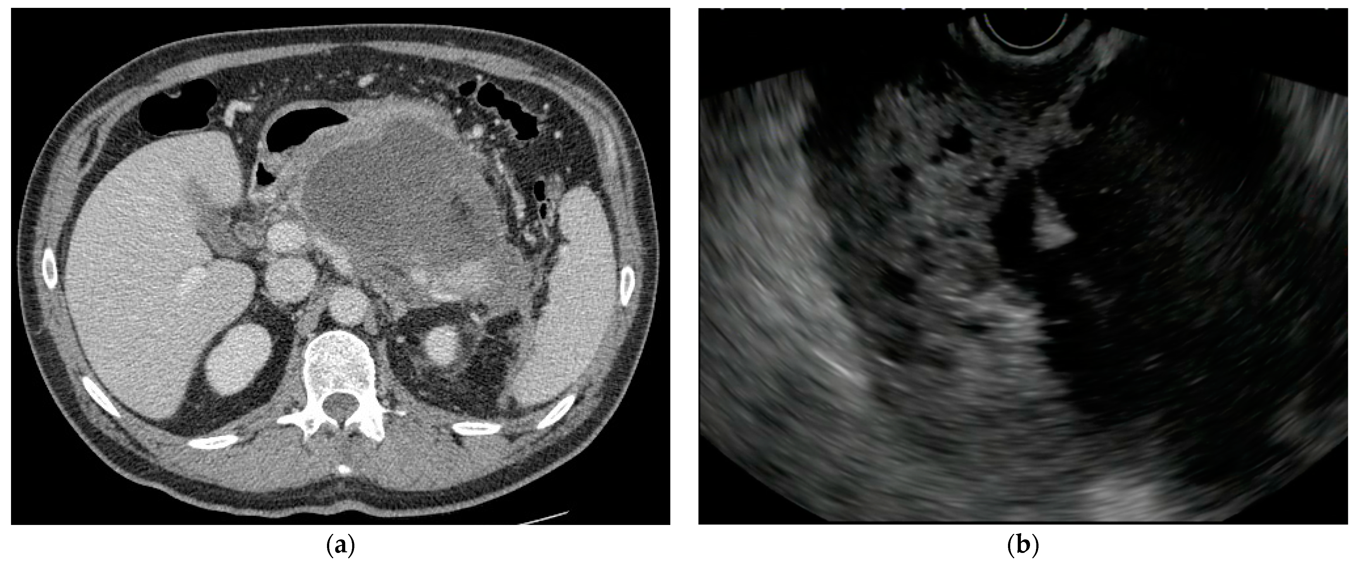 Medicina 60 00333 g001