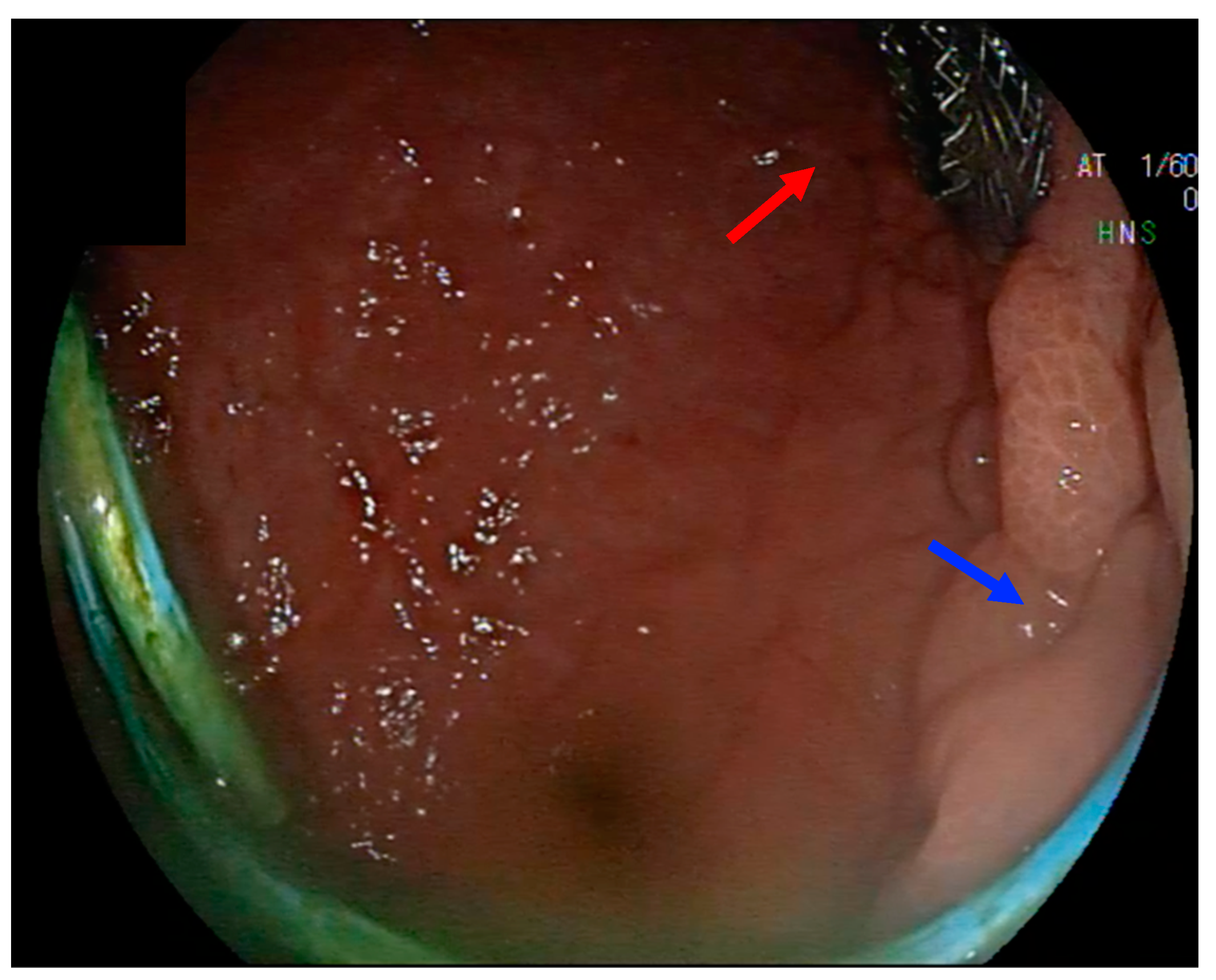Medicina 60 00333 g004
