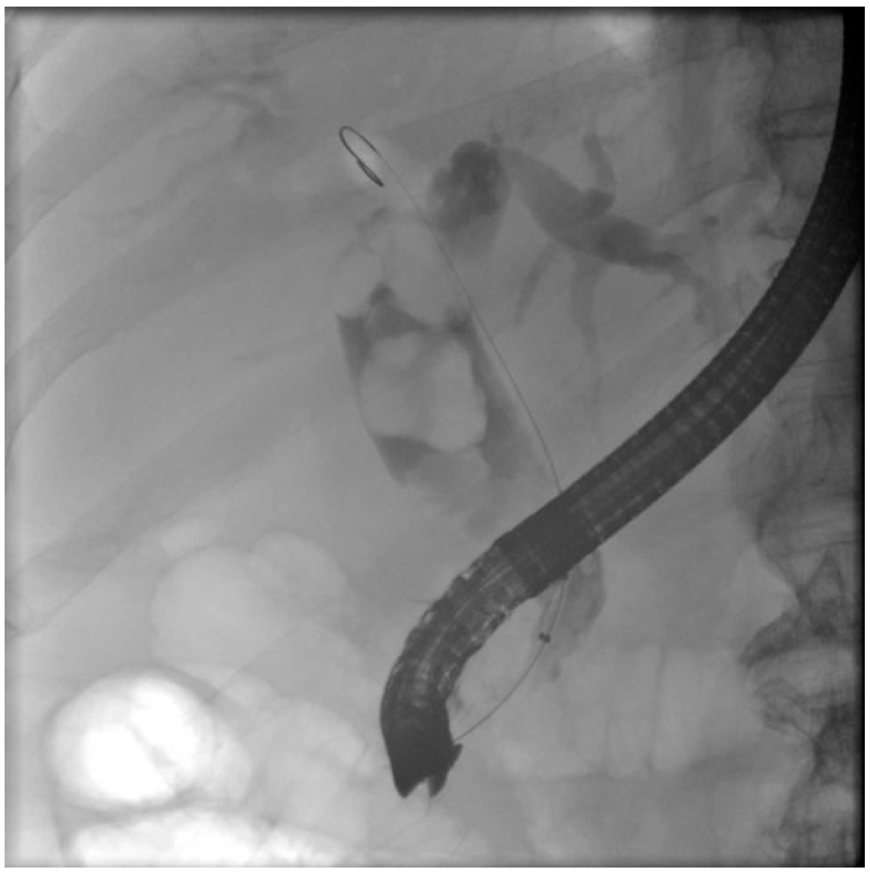 Medicina 60 00340 g001