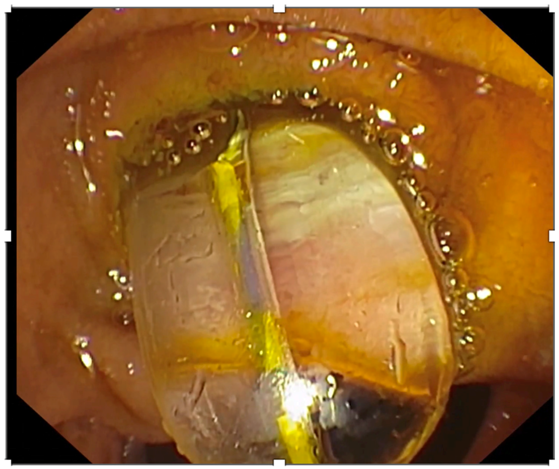 Medicina 60 00340 g002