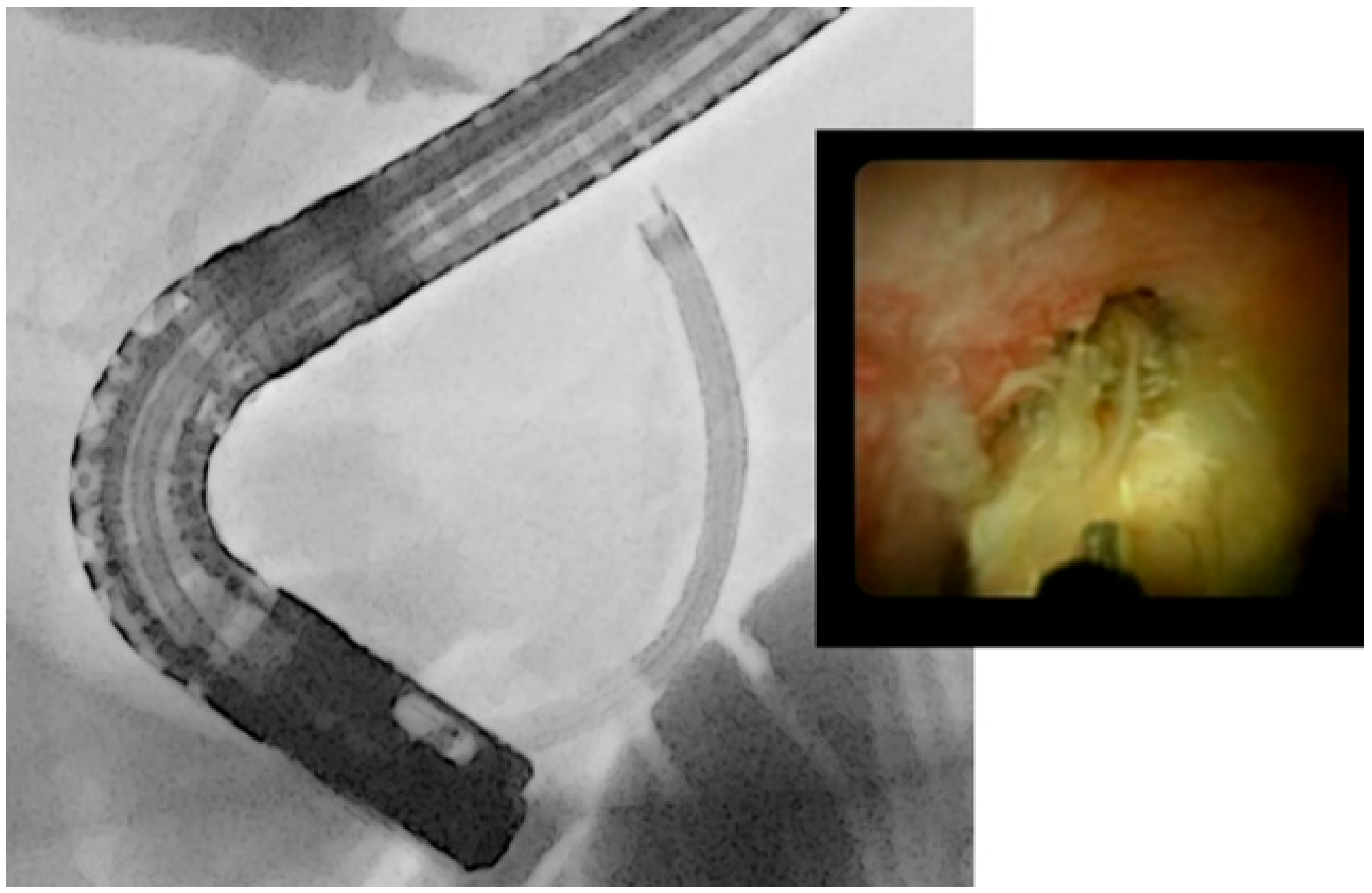 Medicina 60 00340 g004