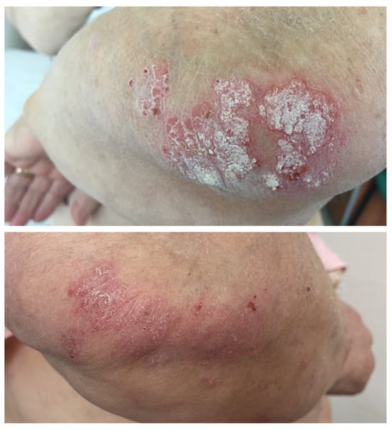 Medicina 60 00373 g005