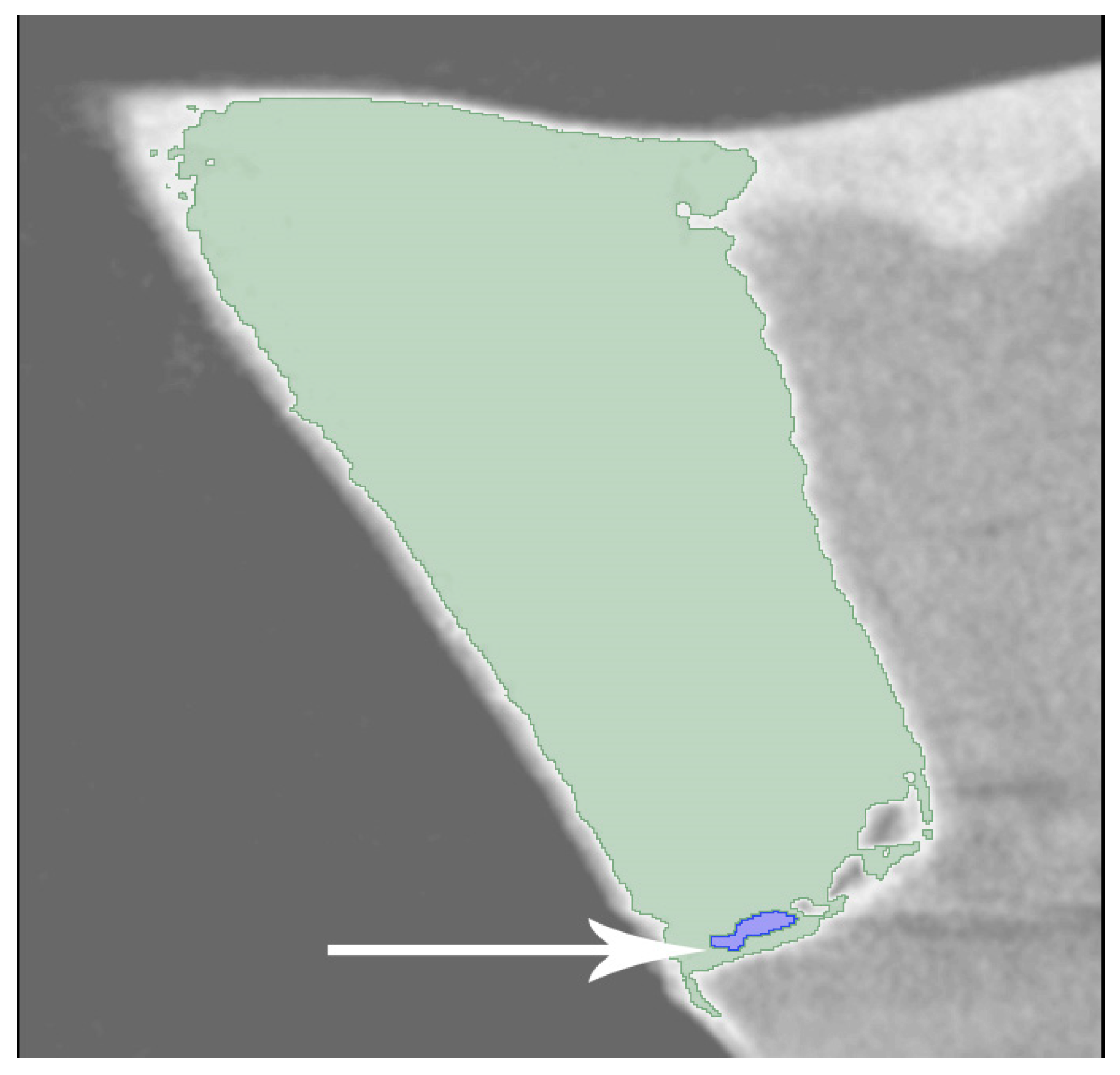 Medicina 60 00396 g002