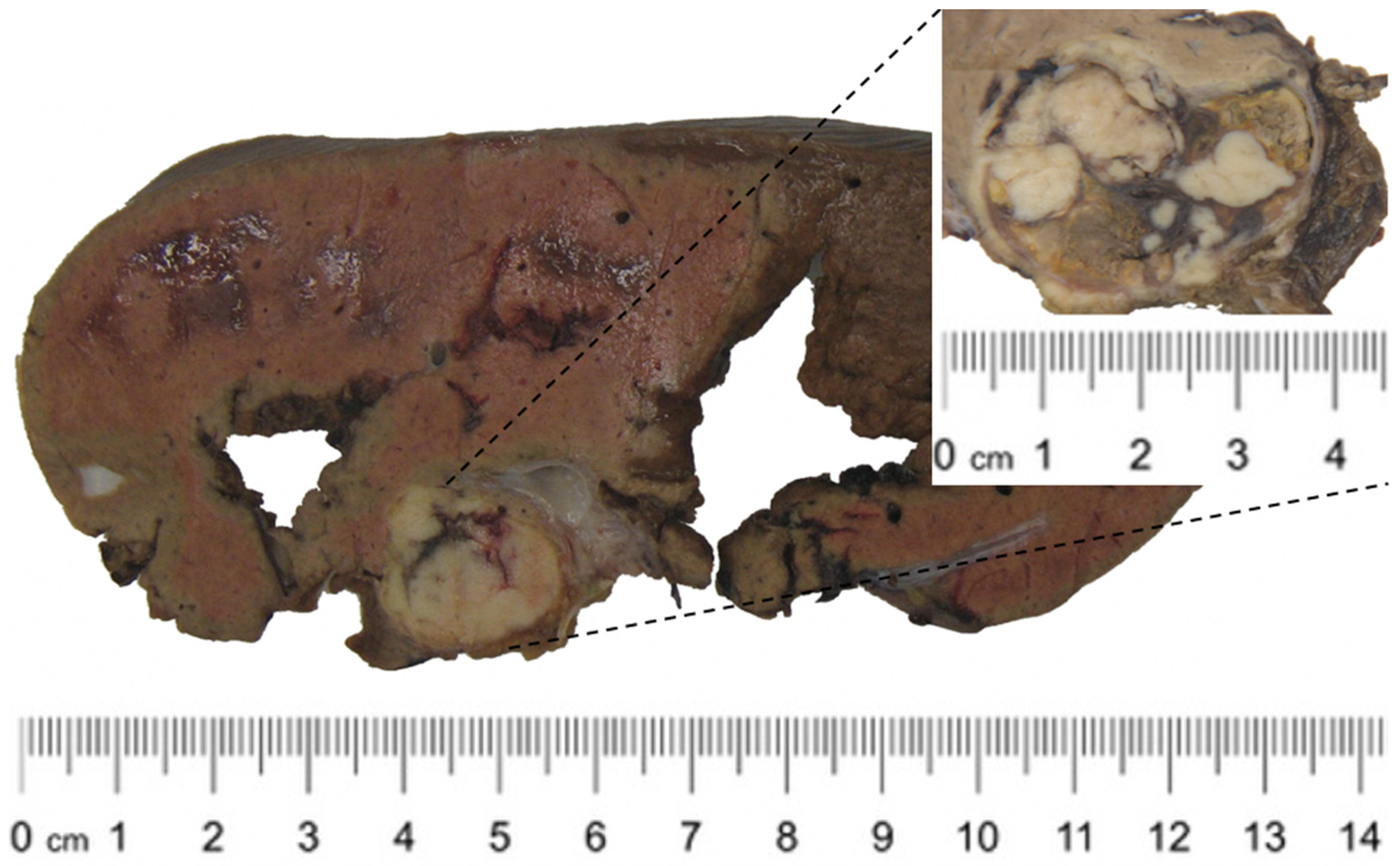 Medicina 60 00409 g002
