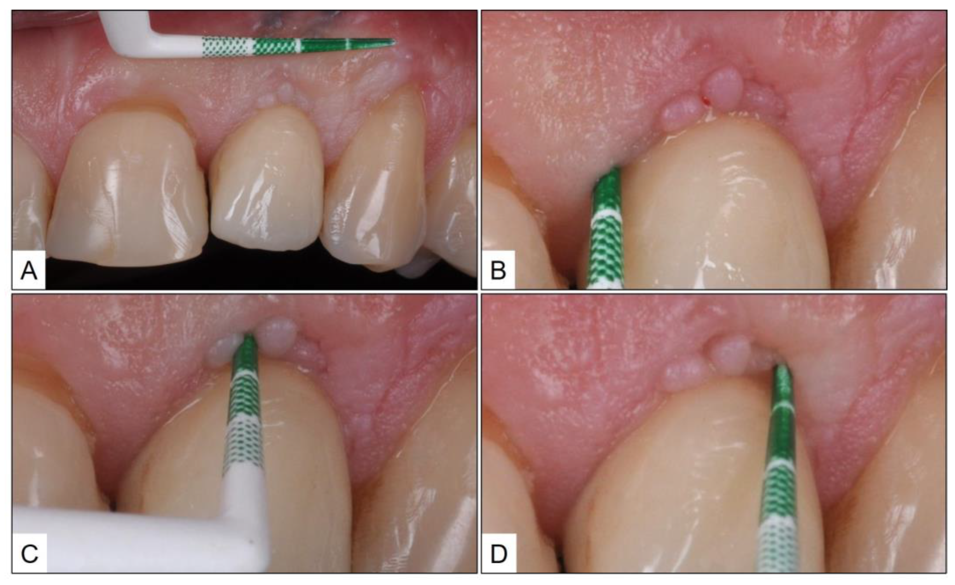 Medicina 60 00447 g003