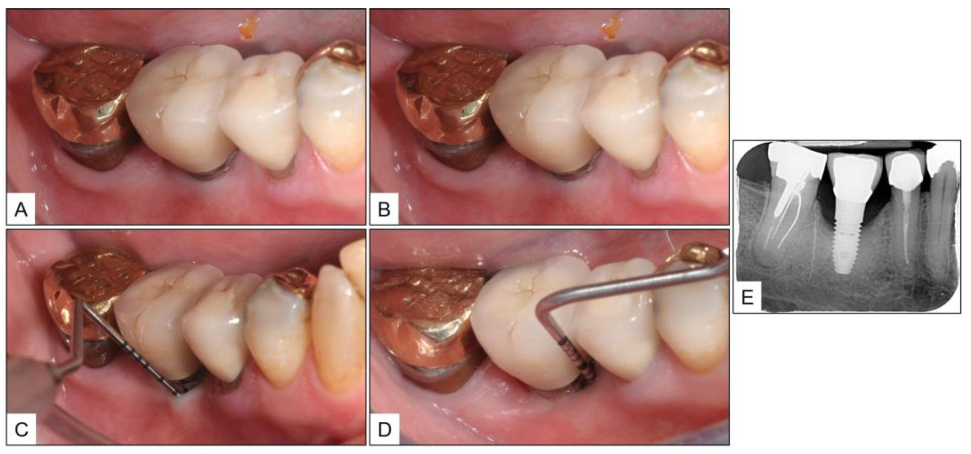 Medicina 60 00447 g006