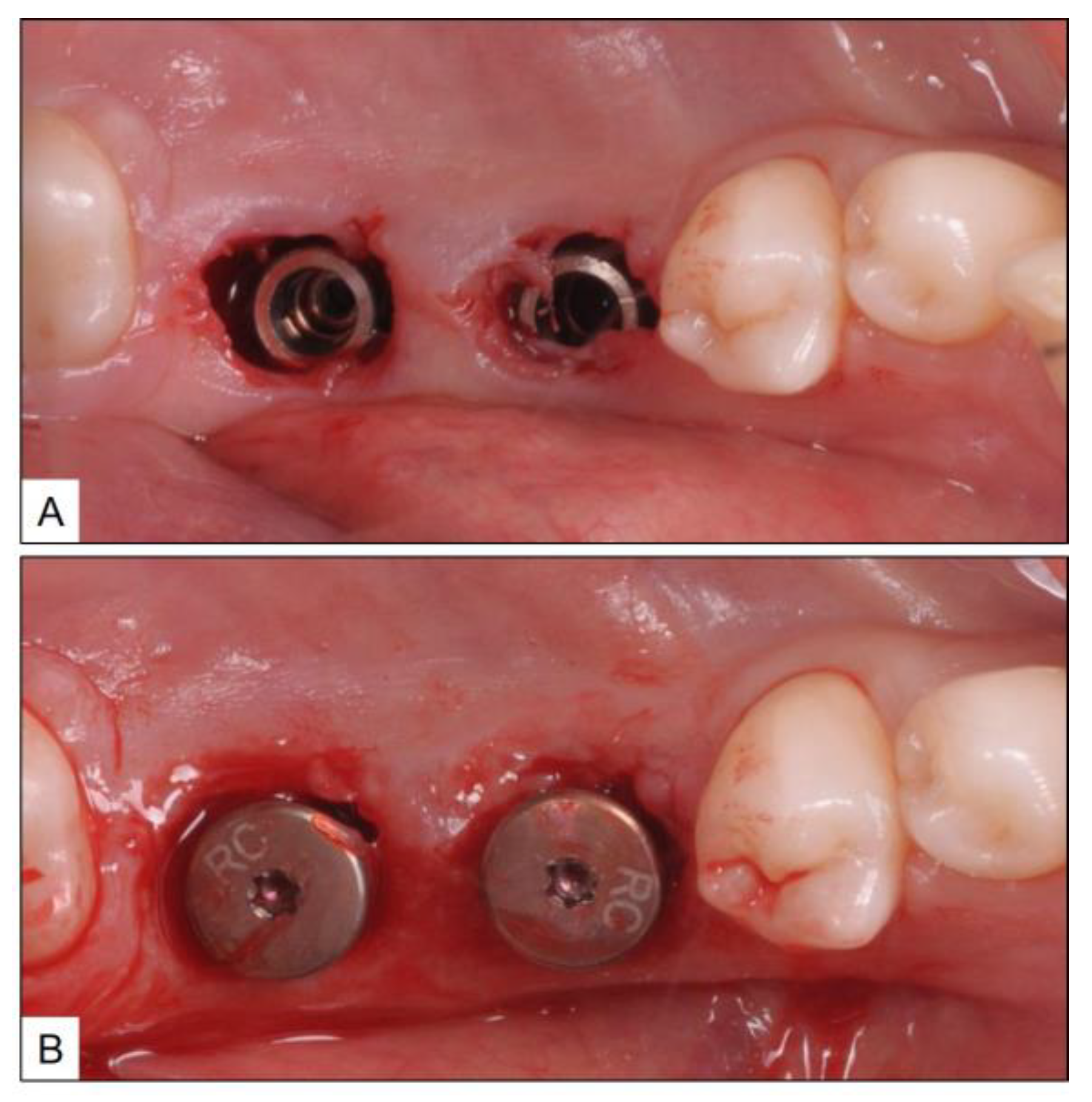 Medicina 60 00447 g008