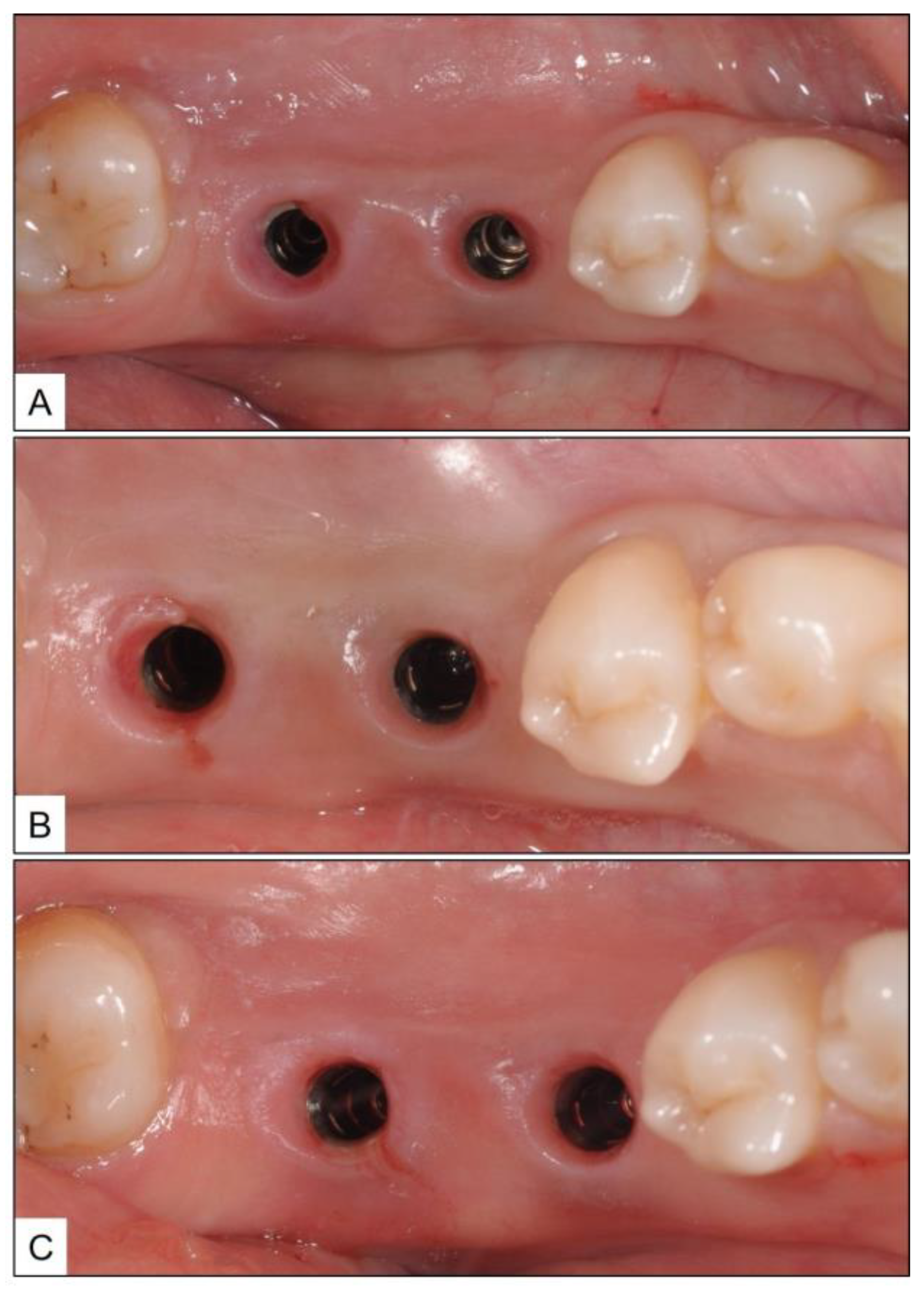 Medicina 60 00447 g009