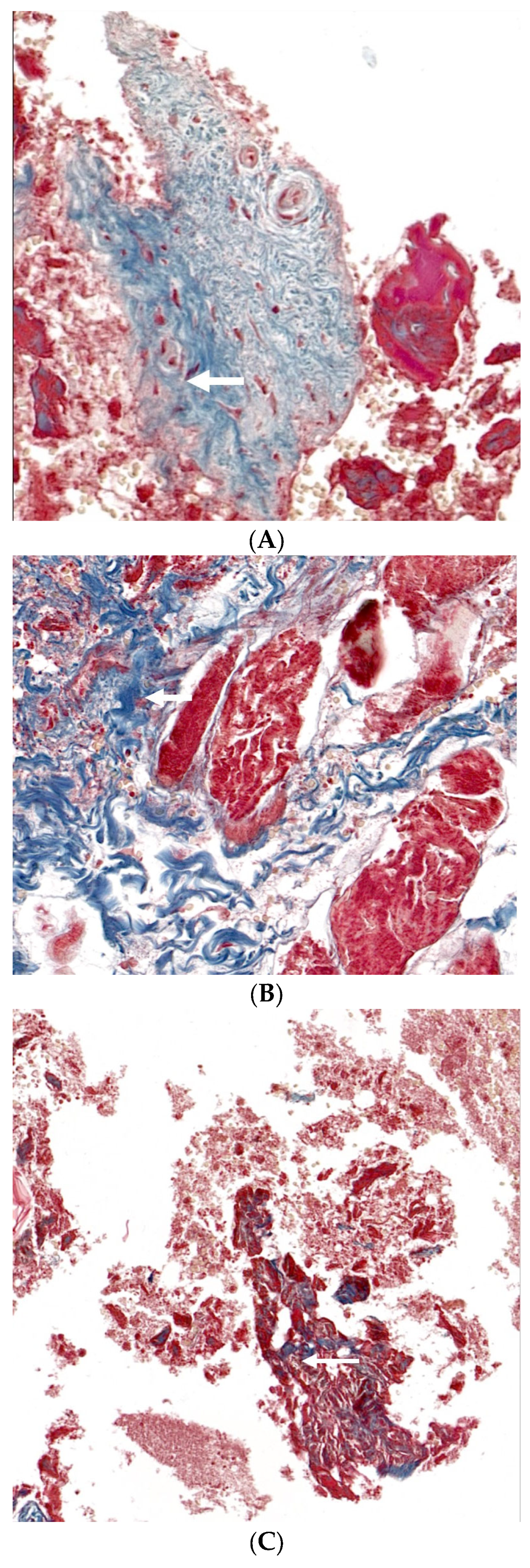Medicina 60 00451 g006a