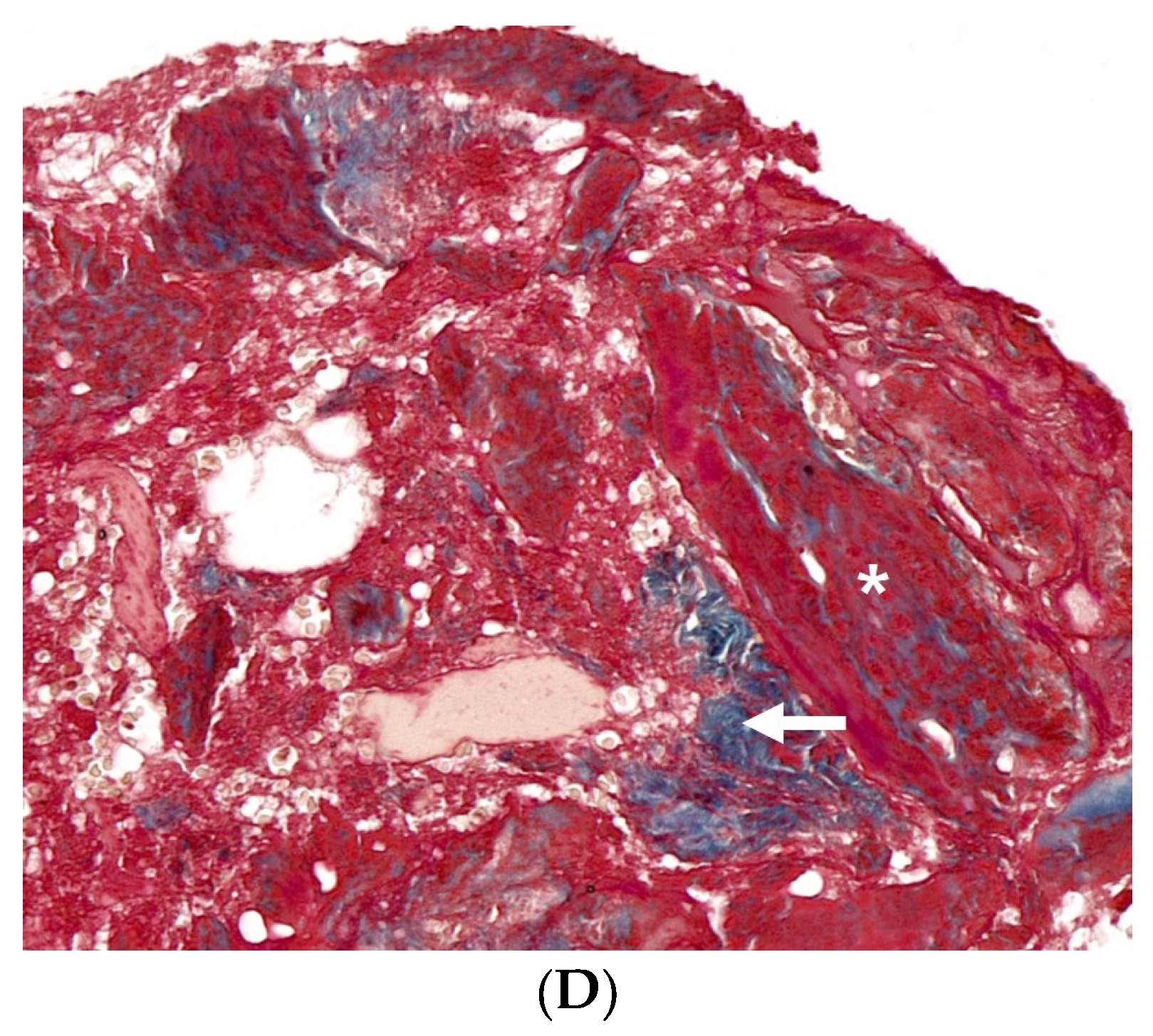 Medicina 60 00451 g006b