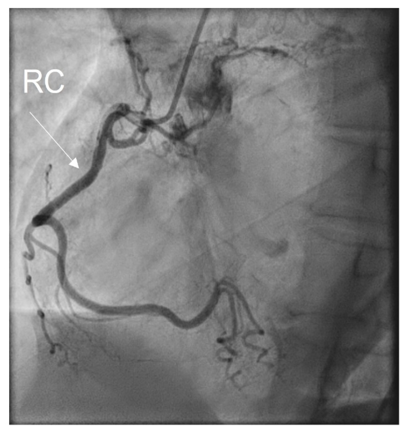 Medicina 60 00456 g007