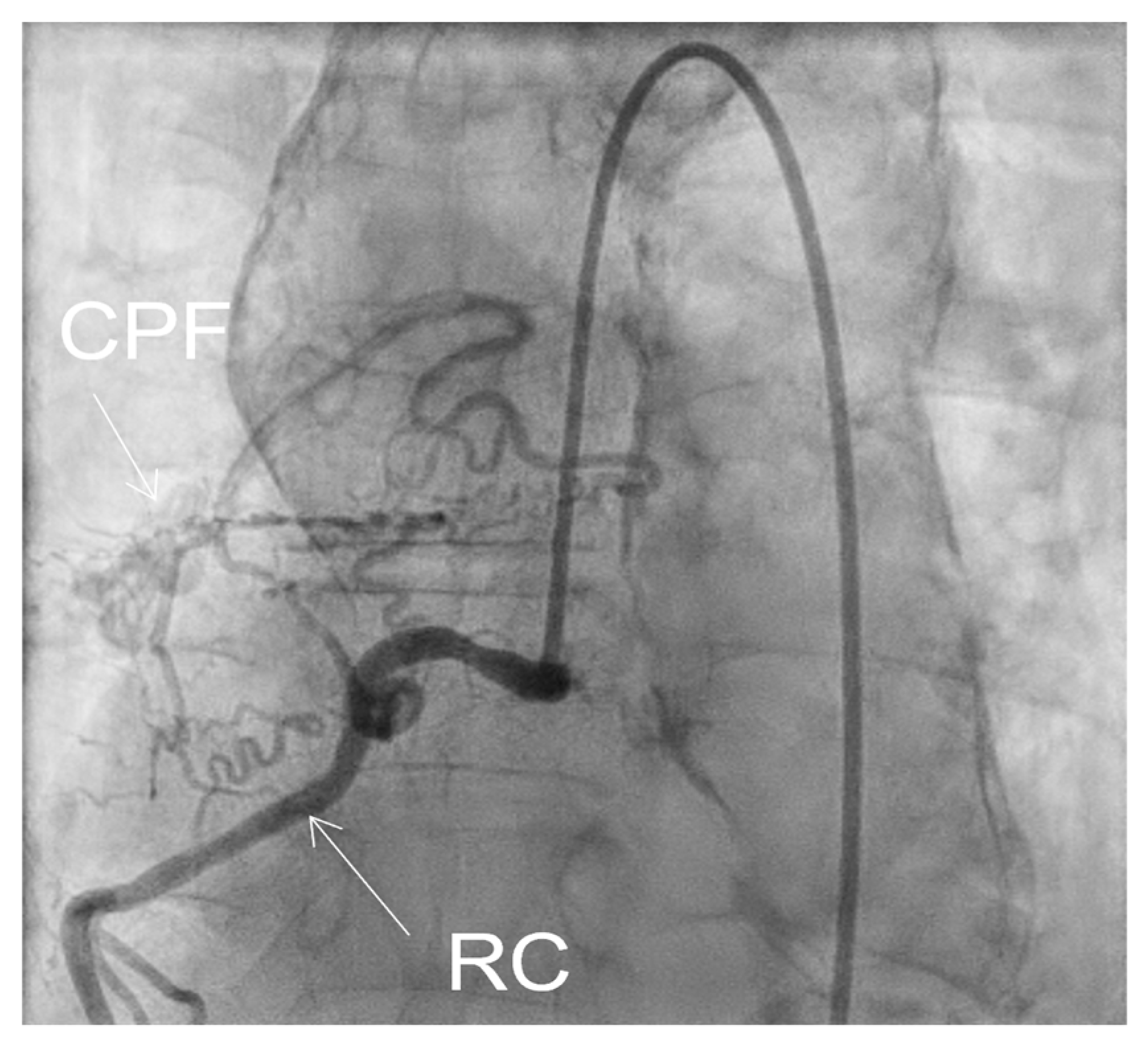 Medicina 60 00456 g009