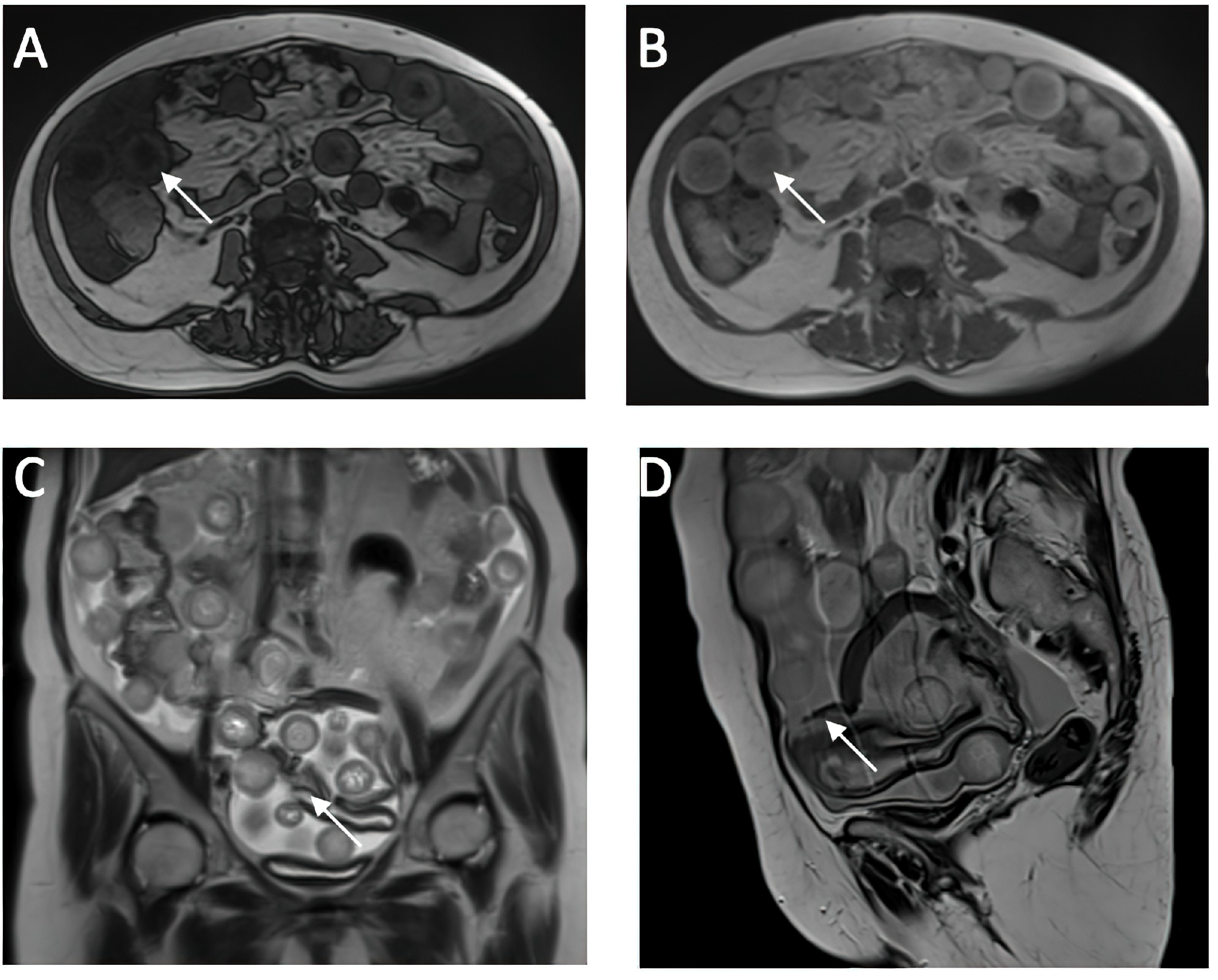 Medicina 60 00460 g002