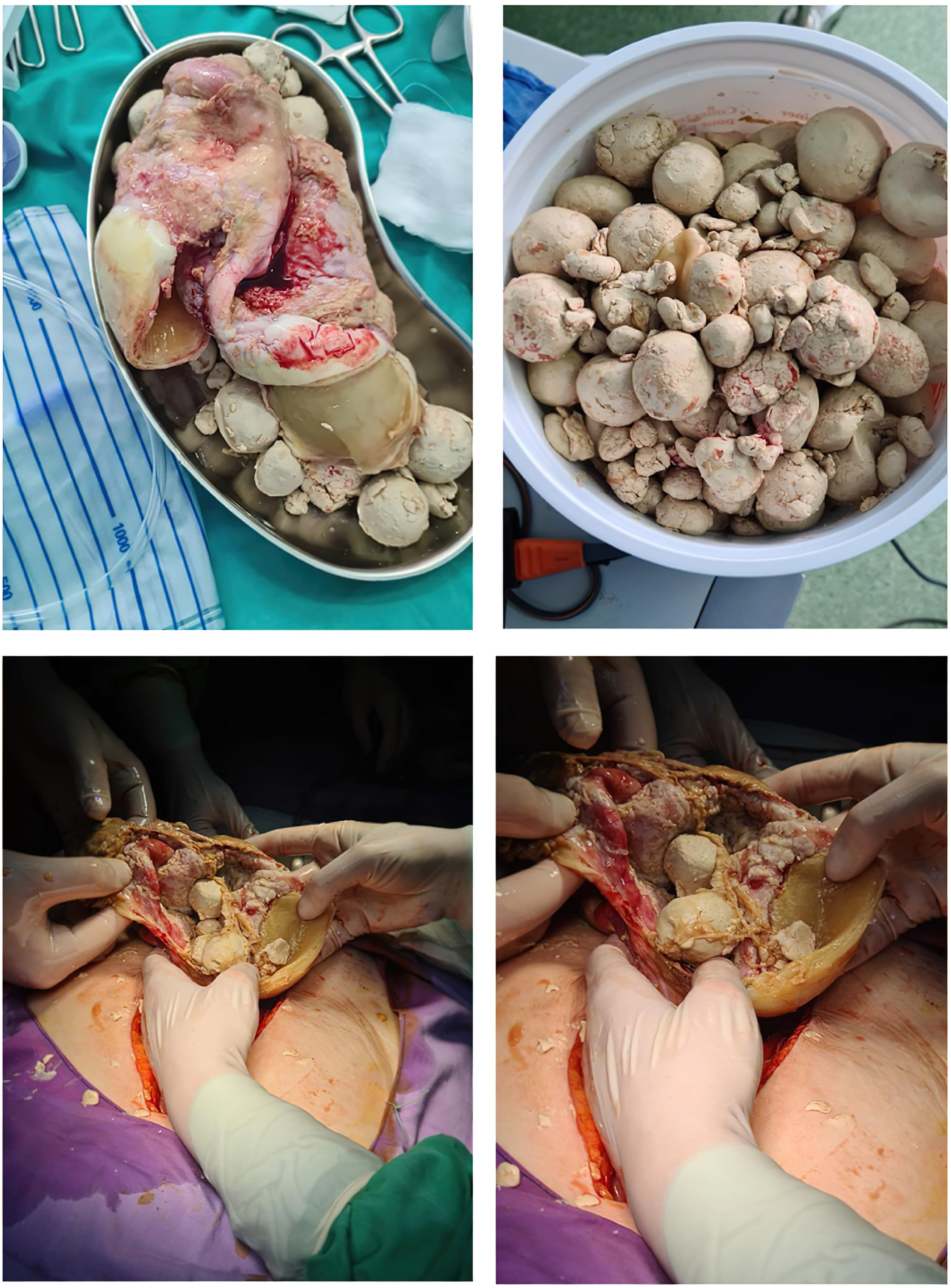 Medicina 60 00460 g003