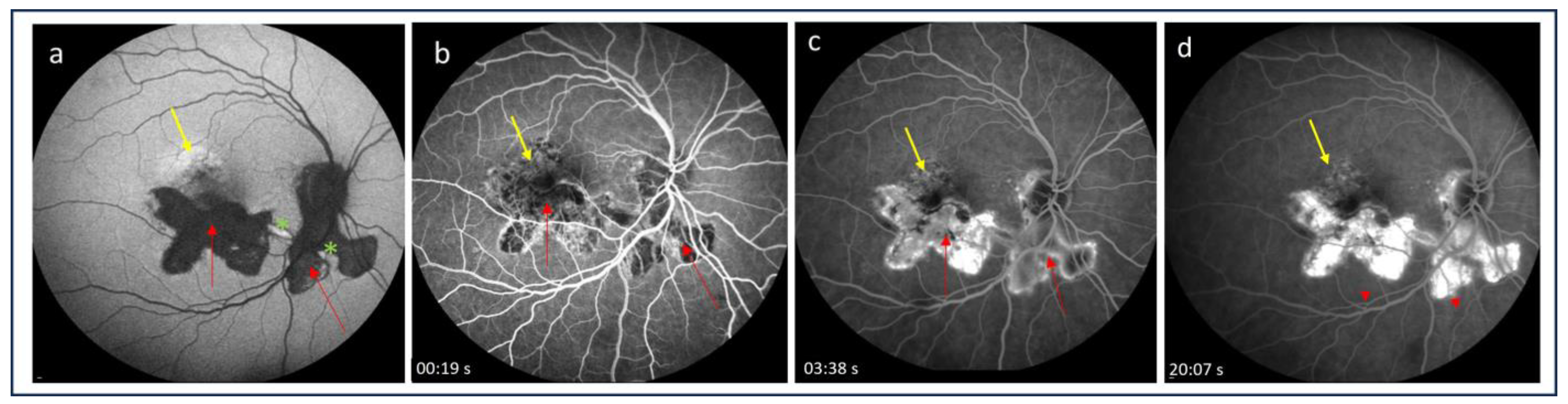 Medicina 60 00465 g001