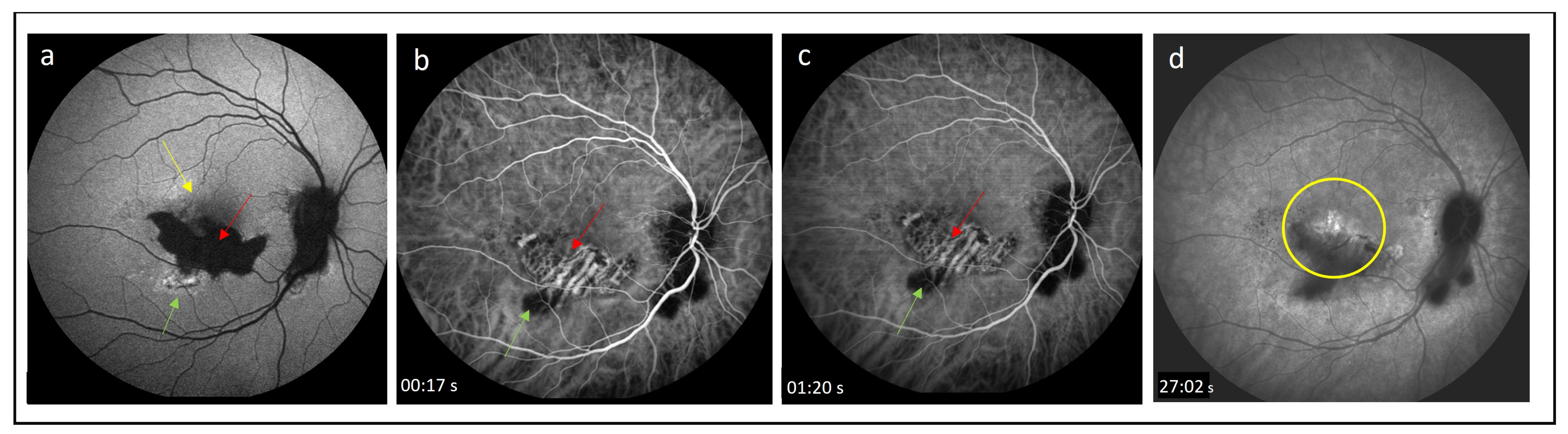 Medicina 60 00465 g003