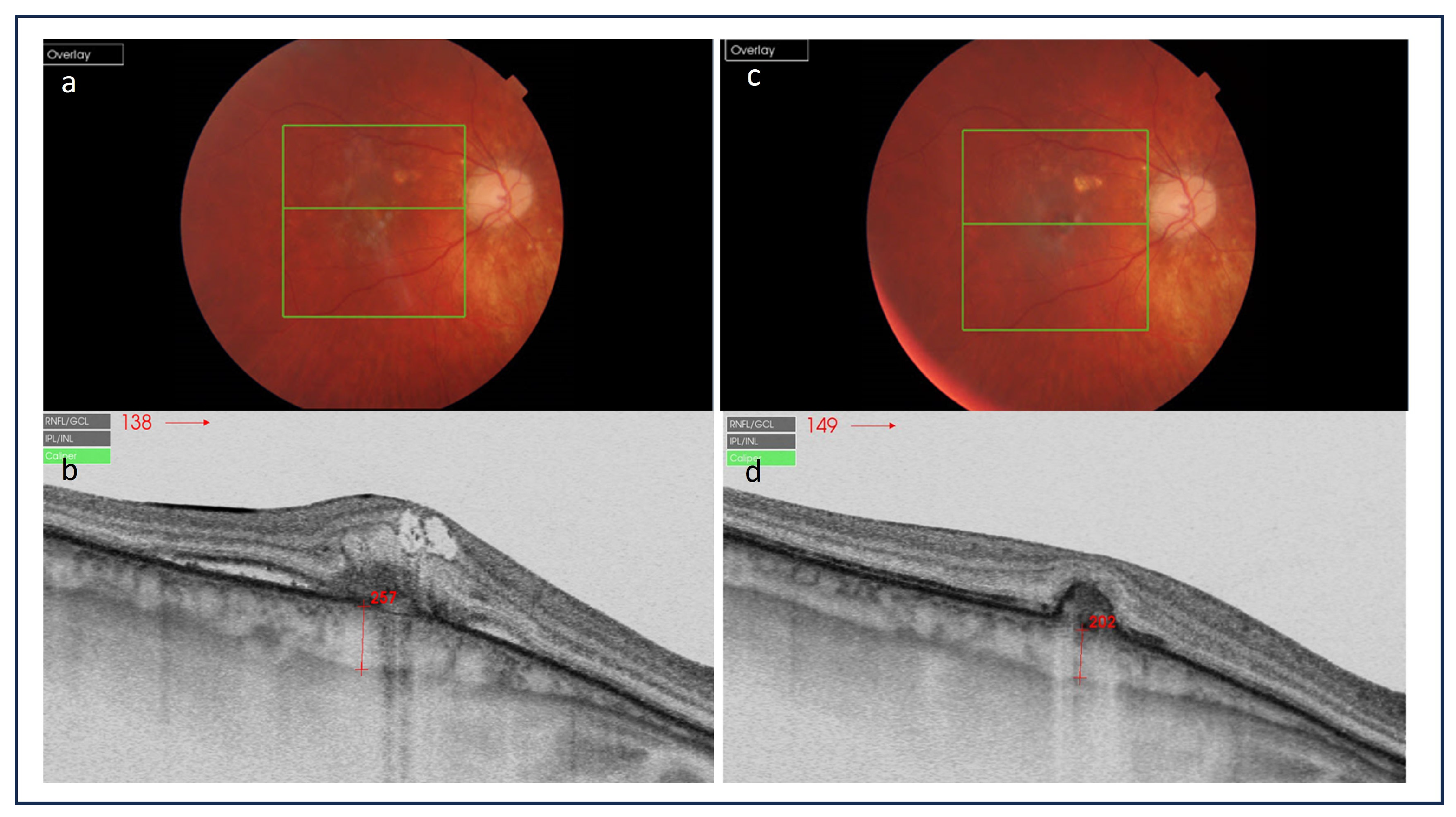 Medicina 60 00465 g007