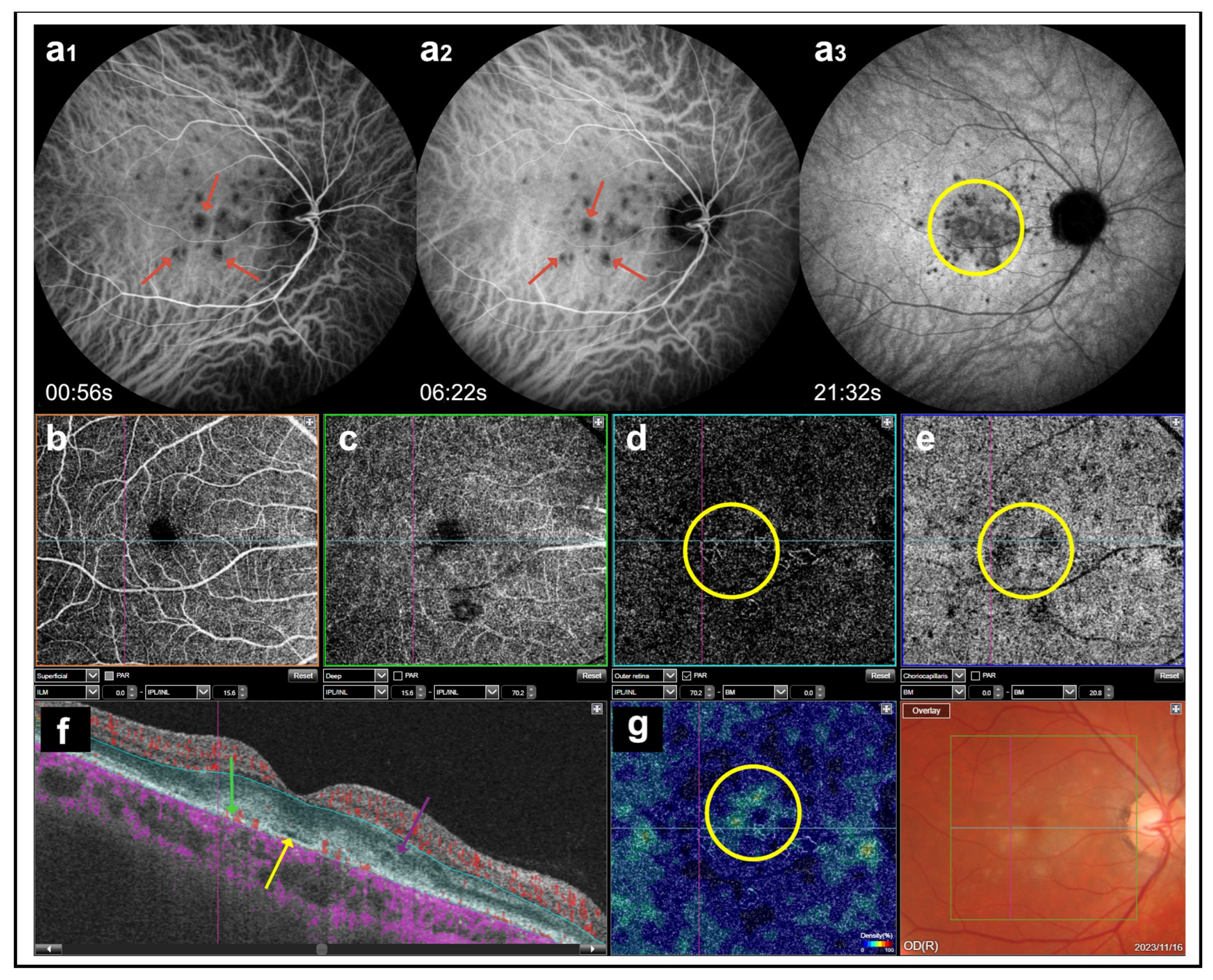 Medicina 60 00465 g008