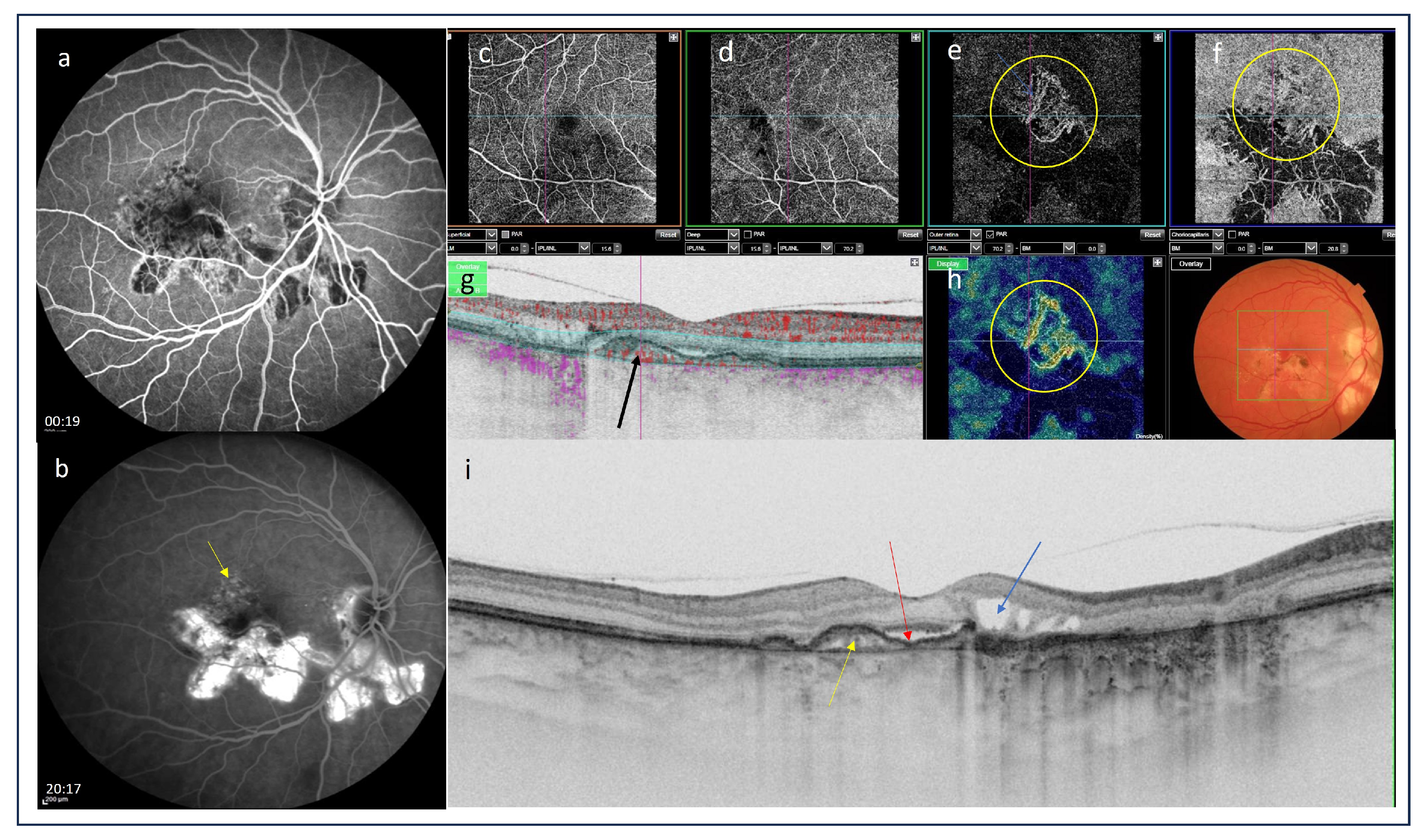 Medicina 60 00465 g009