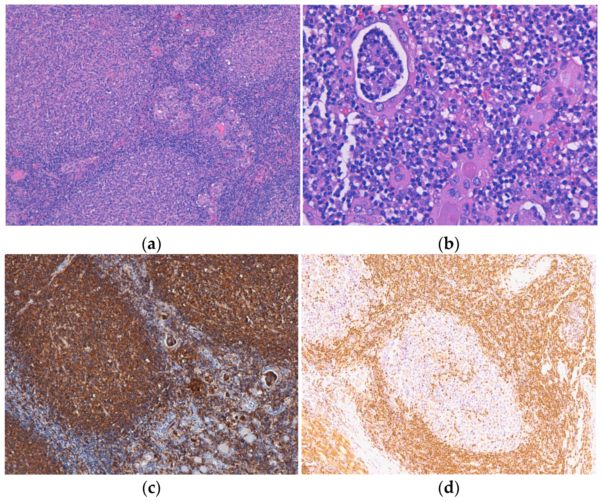 Medicina 60 00476 g003