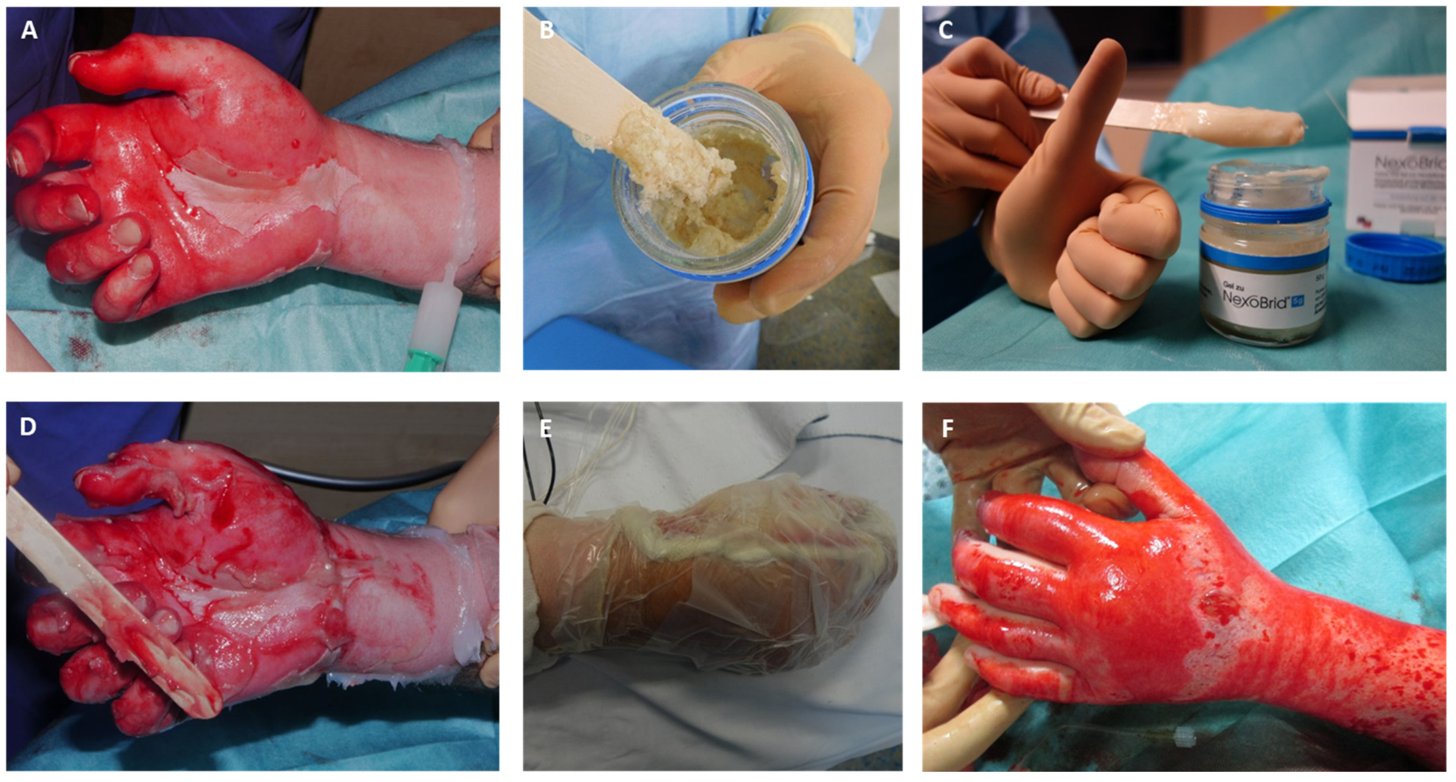 Medicina 60 00481 g003