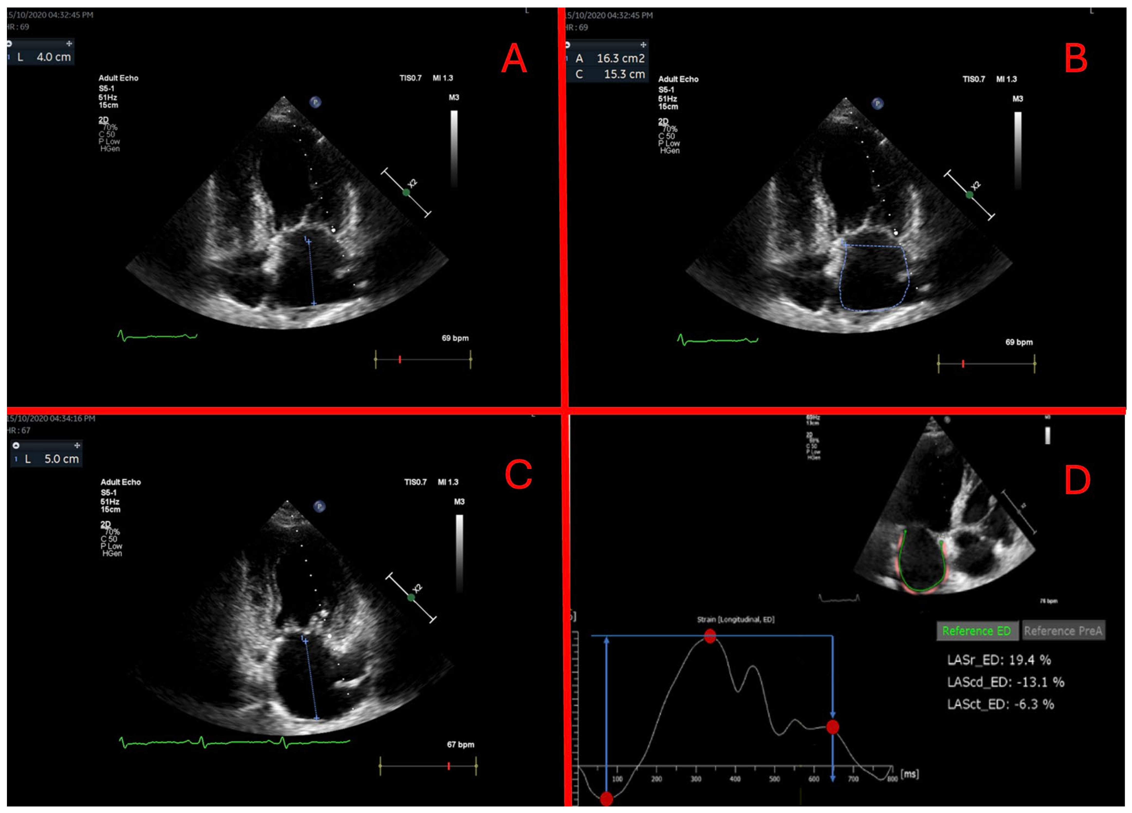 Medicina 60 00503 g001