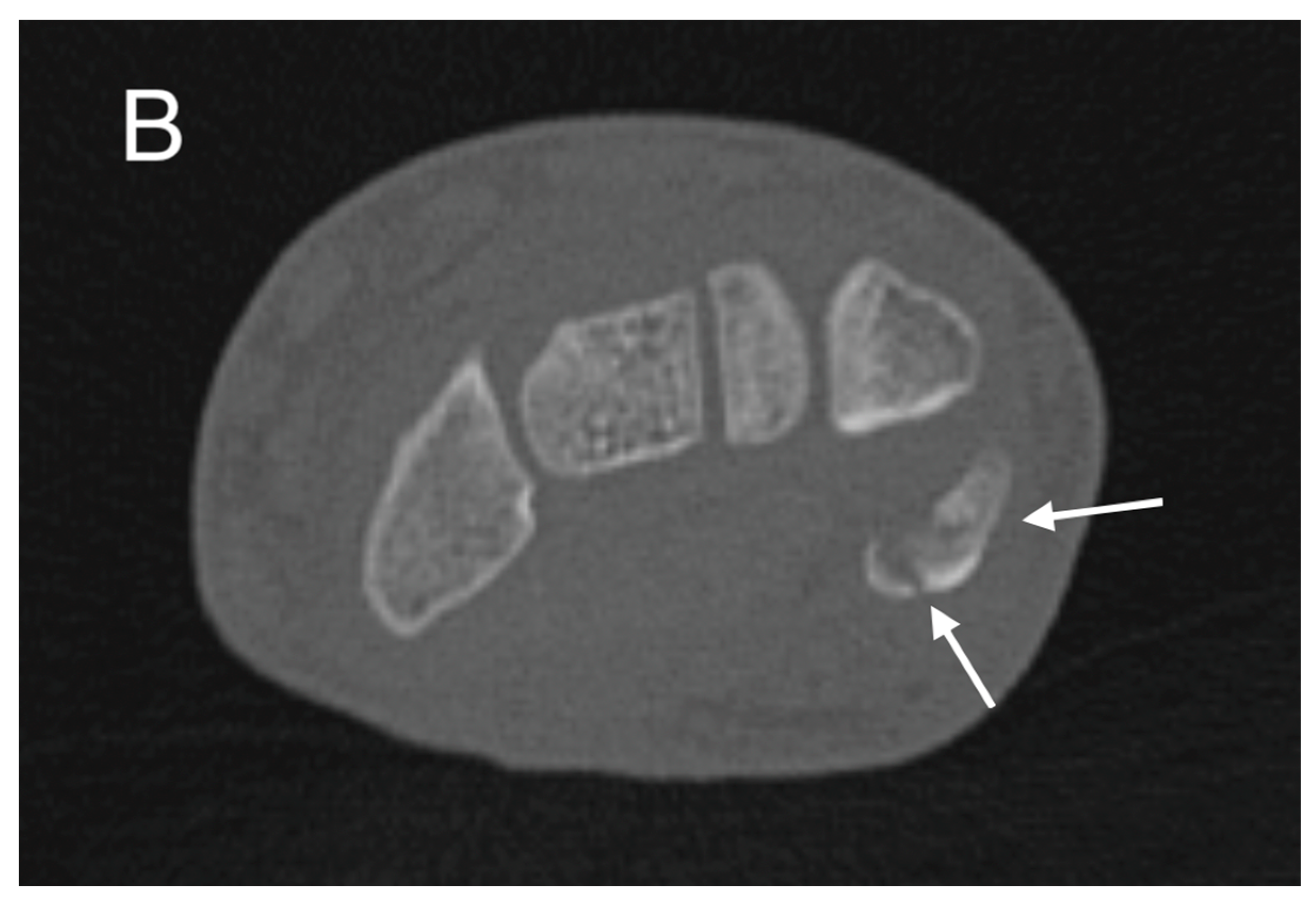 Medicina 60 00532 g002b