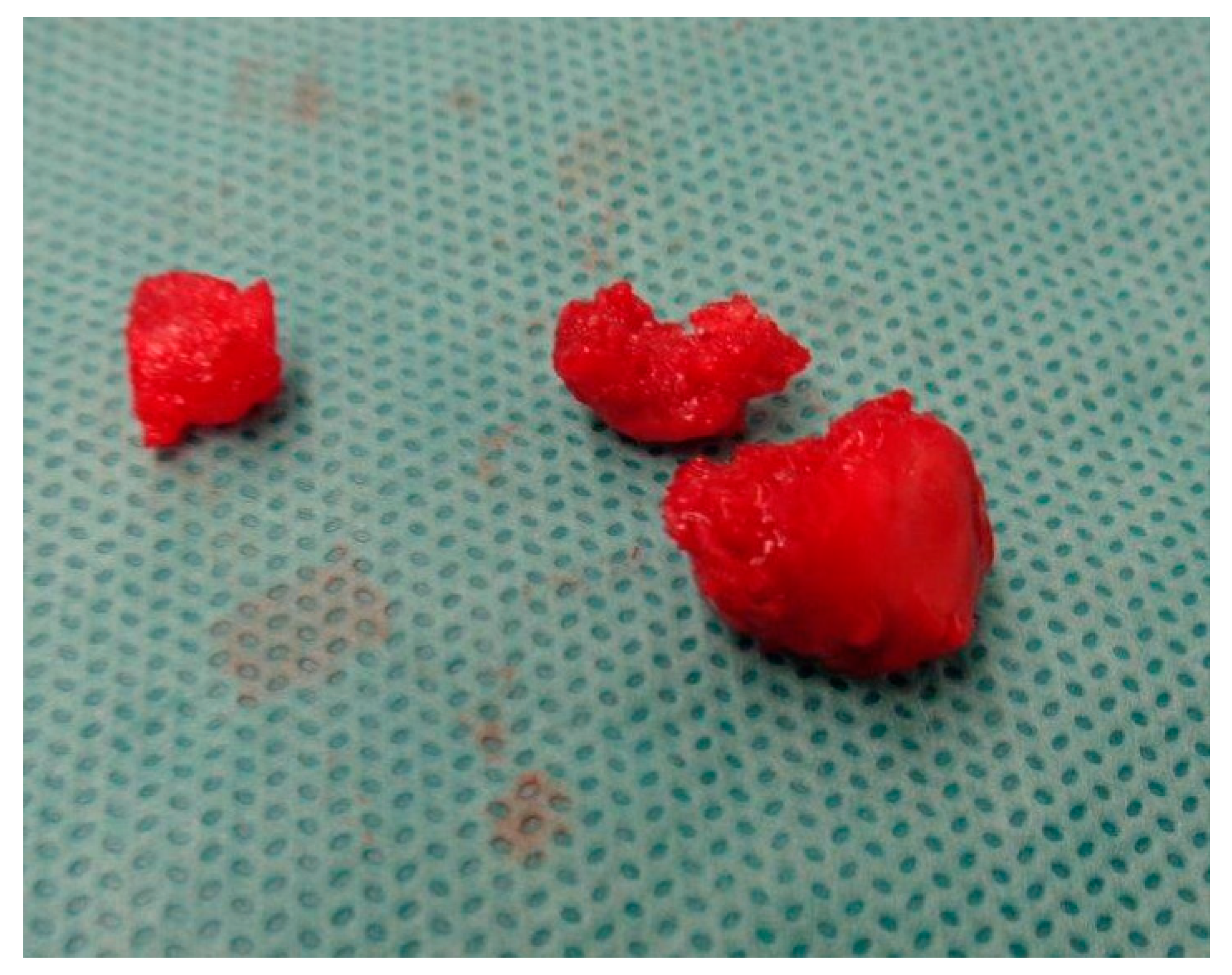 Medicina 60 00532 g004