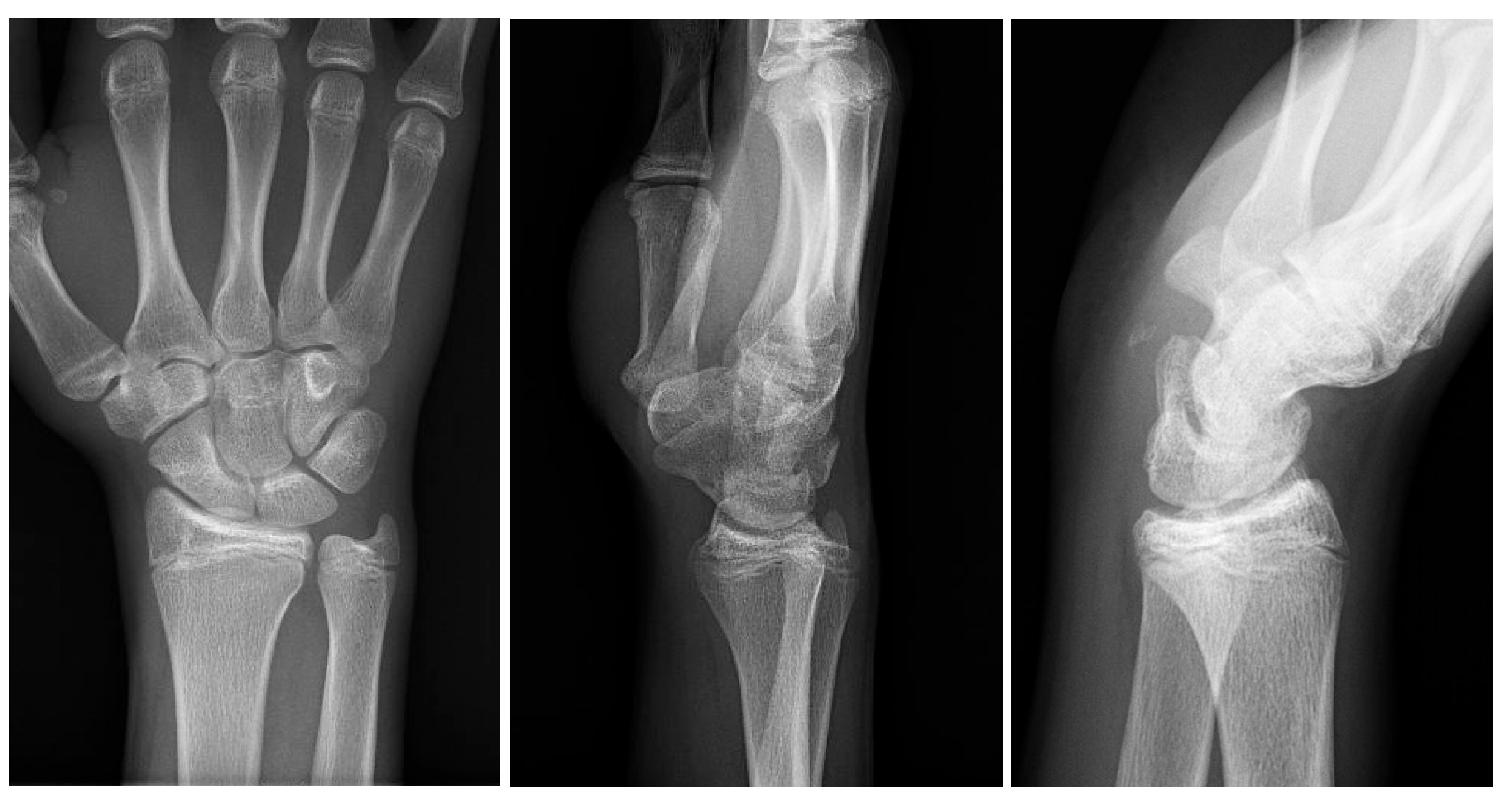 Medicina 60 00532 g005