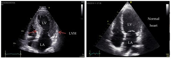 Medicina 60 00543 g001