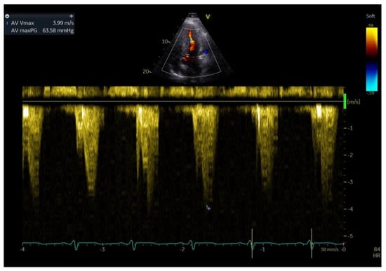 Medicina 60 00543 g002