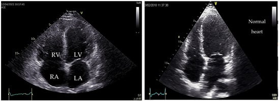 Medicina 60 00543 g003