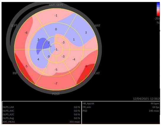 Medicina 60 00543 g004