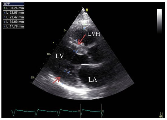 Medicina 60 00543 g005
